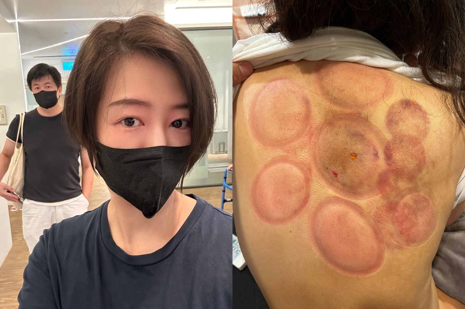 台8女星太操勞出事了!疼痛難耐緊急就醫 謝尪暖心奔走當「鋼鐵後盾」