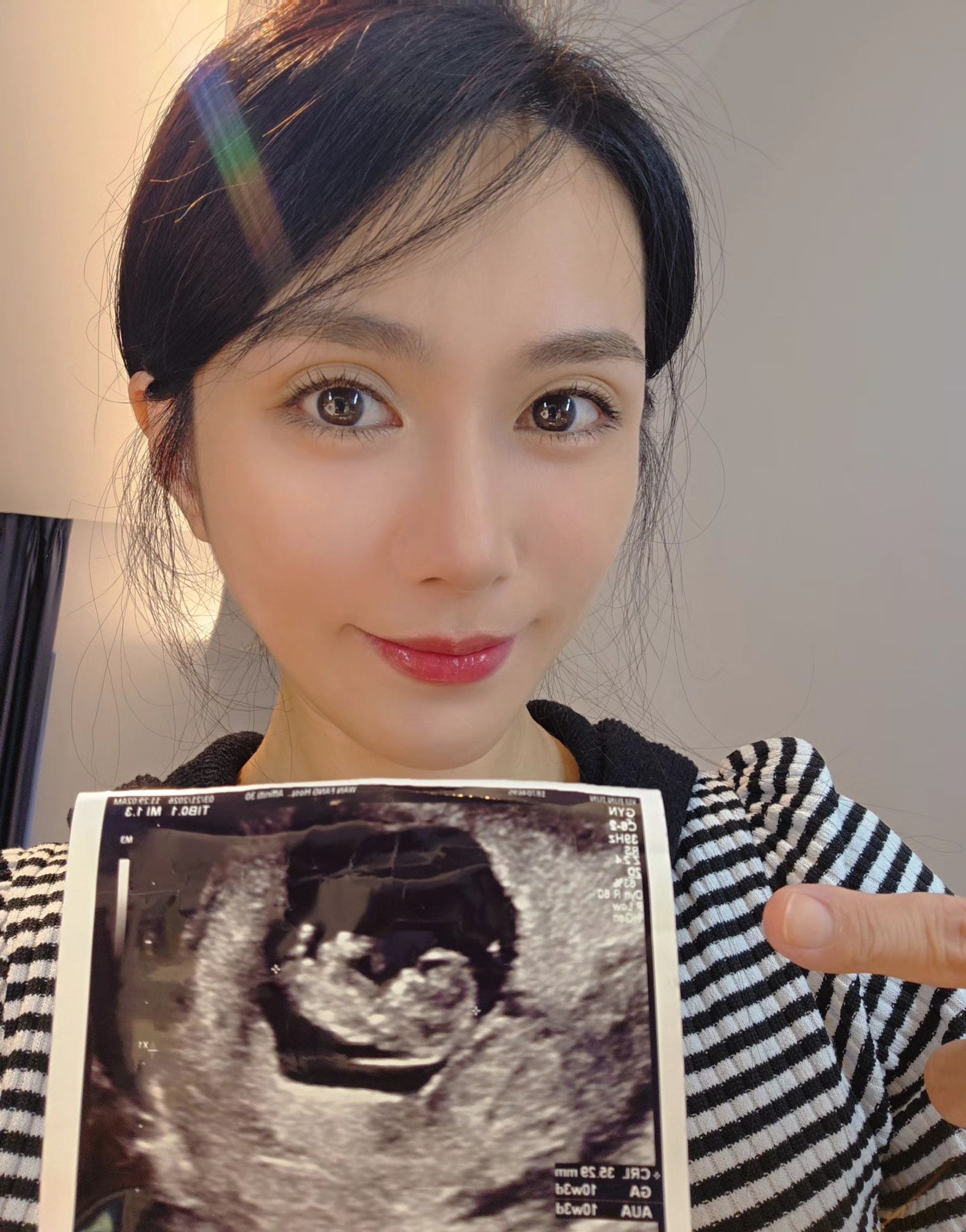 許鈞鈞分享超音波照宣布懷孕。翻攝臉書