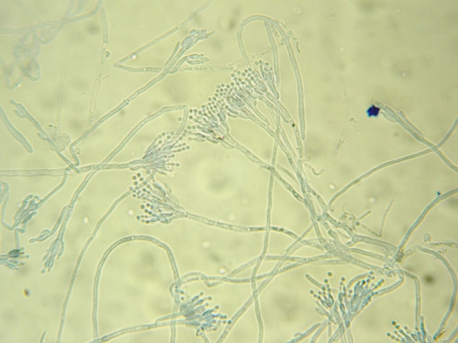 英國爆「致命黴菌」蔓延72家醫院：90天內6成死亡　傳染力強、可潛伏多年
