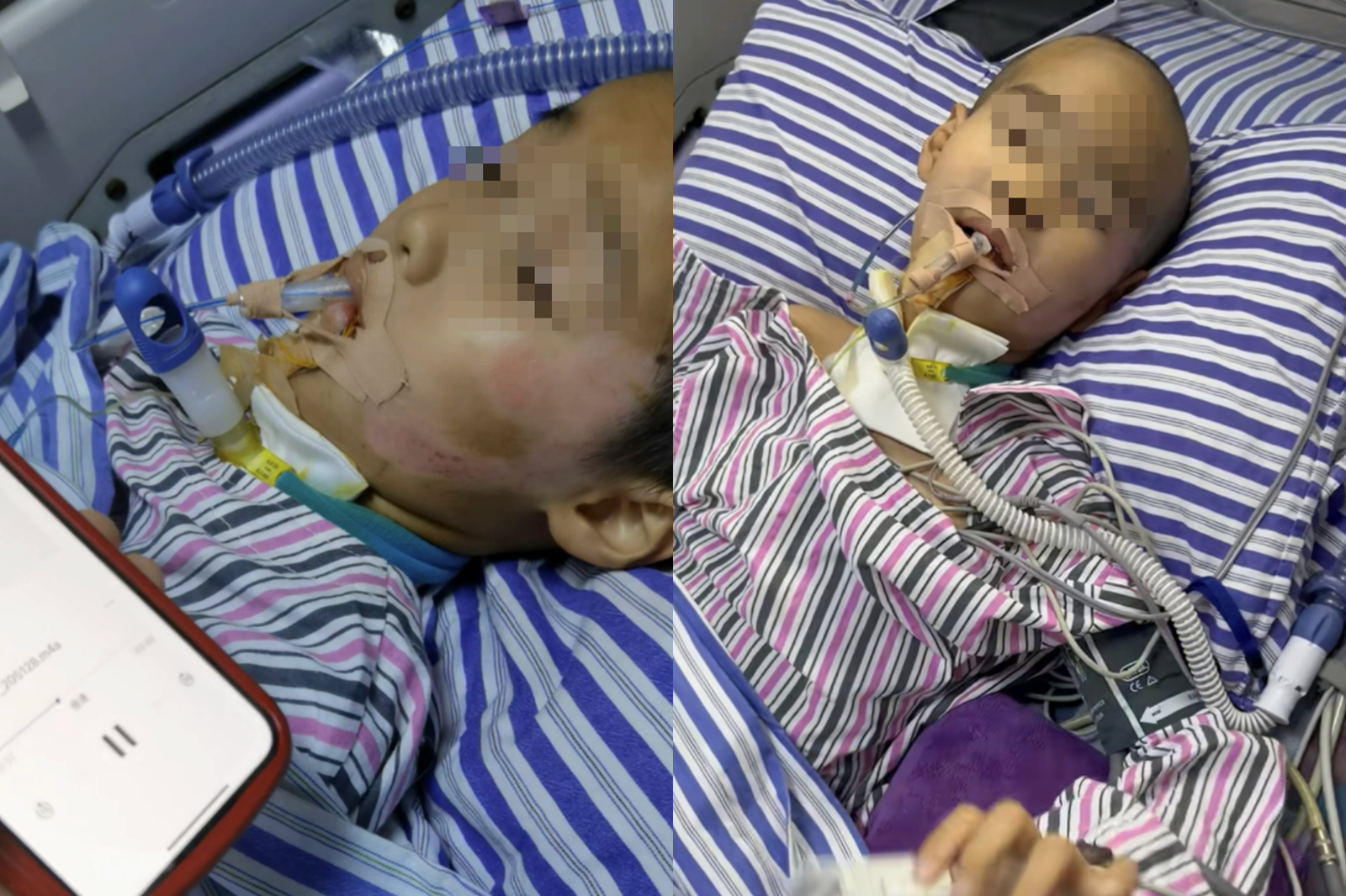 感動奇蹟！8歲男童車禍昏迷55天　同學齊拍影片呼喚「真的醒了」