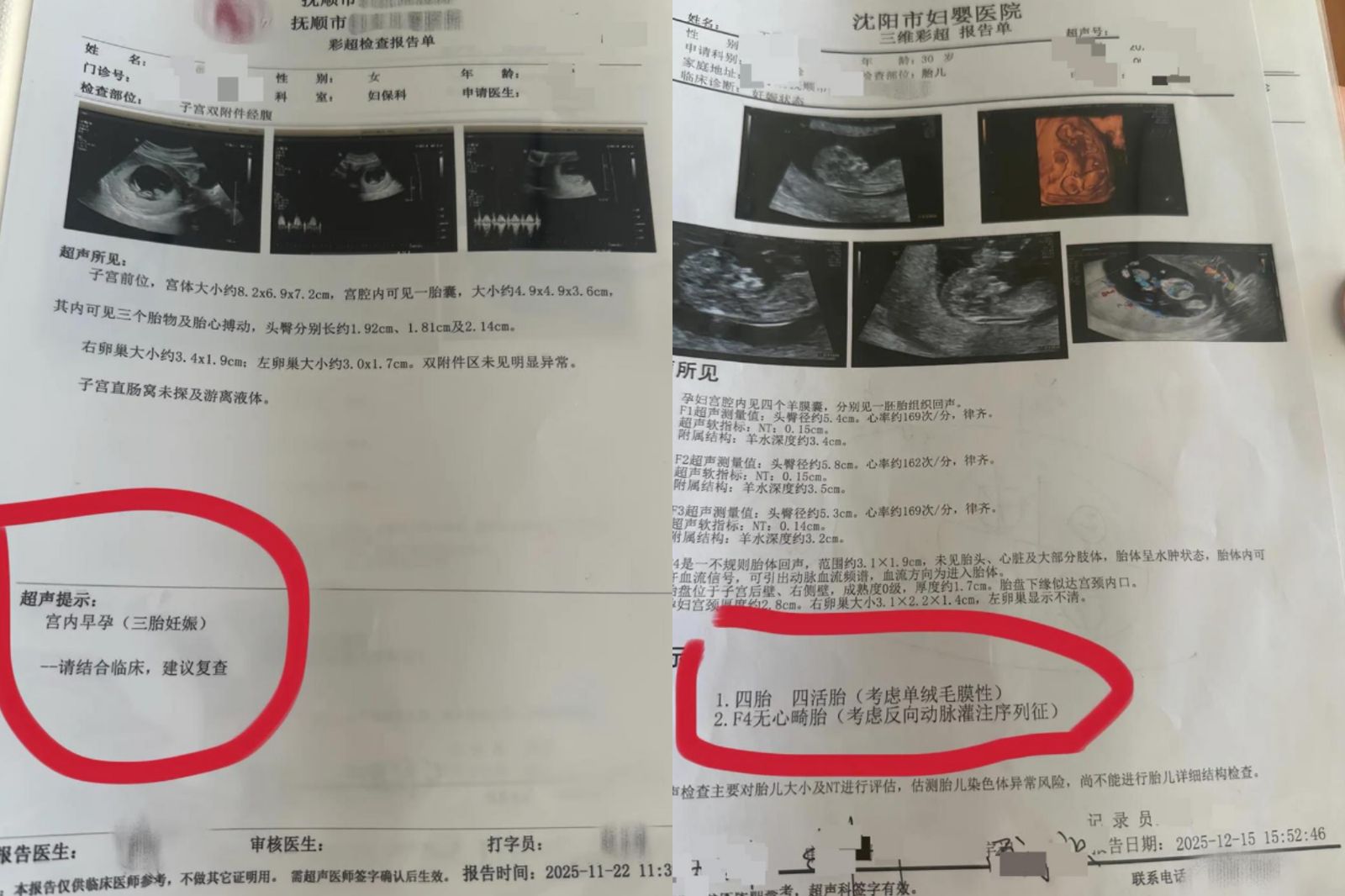 女子去年11月22日進行產檢發現第3胎，12月15日第4次產檢發現第4胎。圖／翻攝自微博