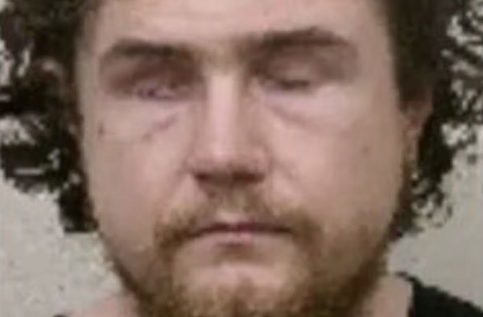 他獄中自殘「挖出雙眼還割舌」　醫作證「智力高於常人」遭裁定仍需受審