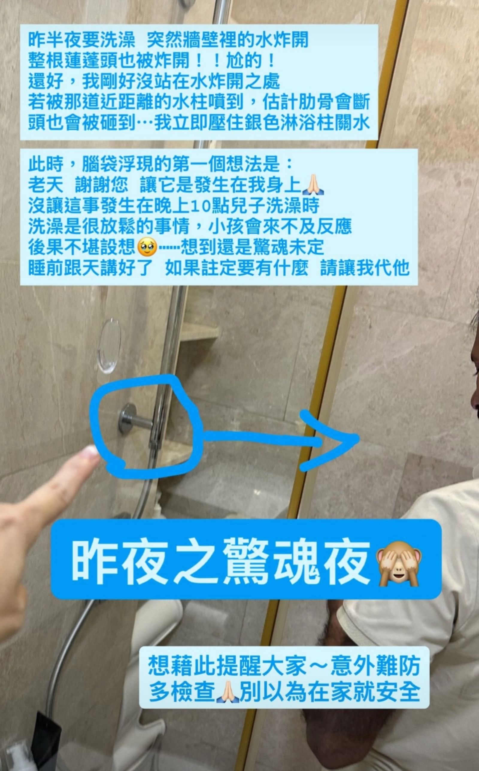 徐若瑄在社群分享意外經過。翻攝vivianhsu.ironv IG限動