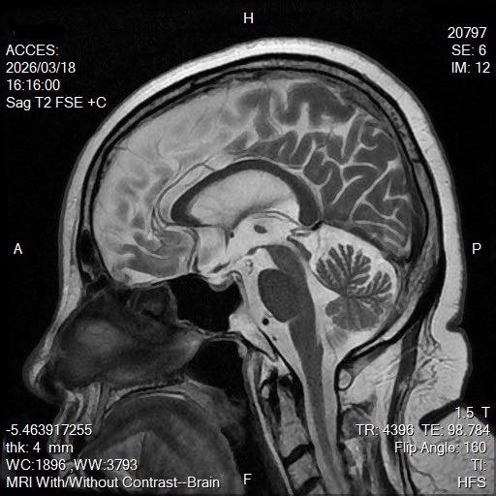陳文茜自述如藝術品般的腦部MRI。翻攝陳文茜臉書