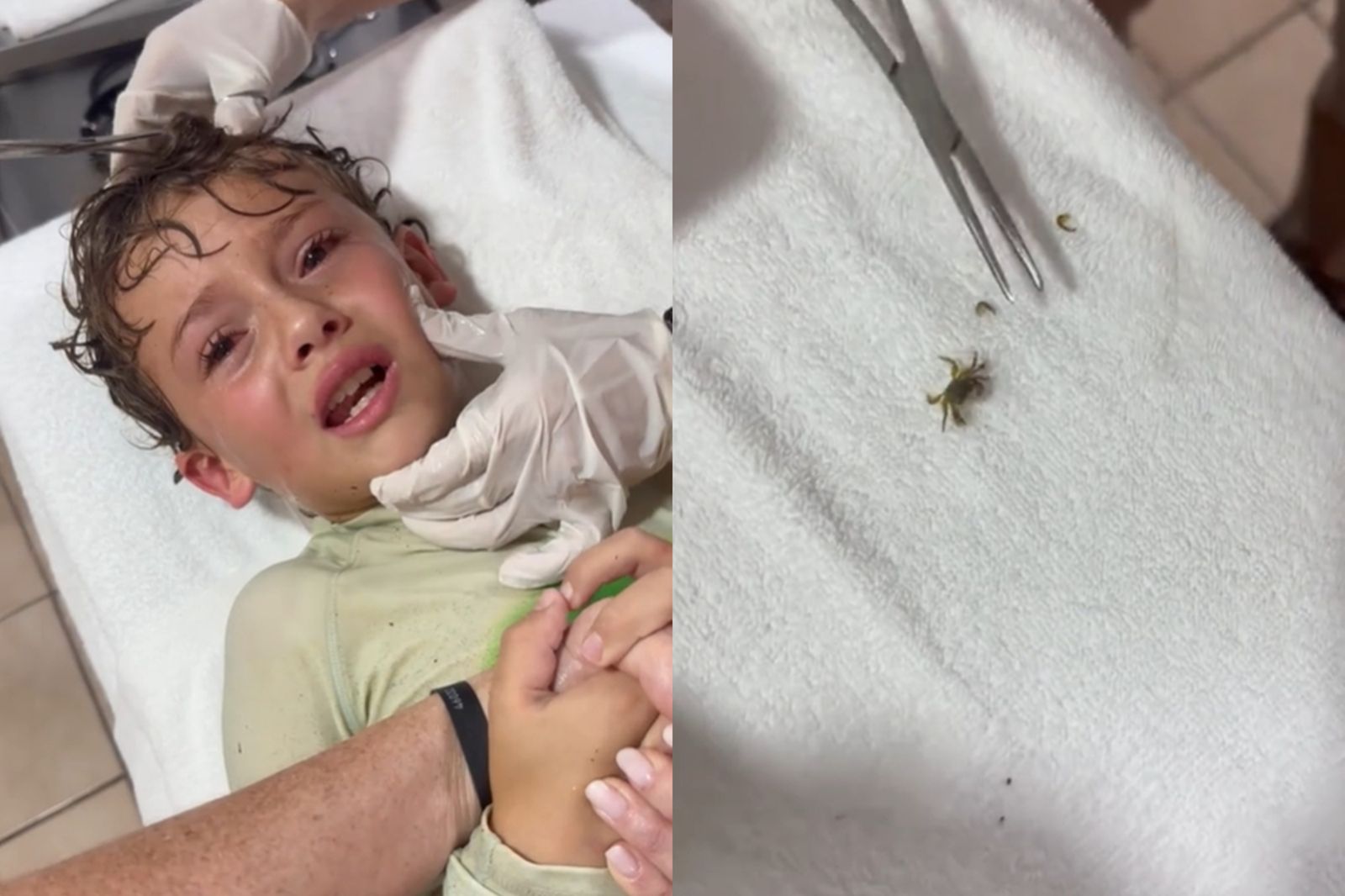 7歲童海邊戲水「耳朵暴痛」急送醫！竟取出「活生生的螃蟹」離奇畫面曝光