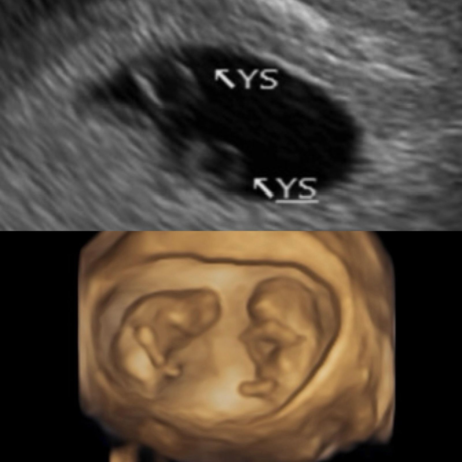 鄭家純曬出超音波照宣布喜訊。翻攝鄭家純臉書