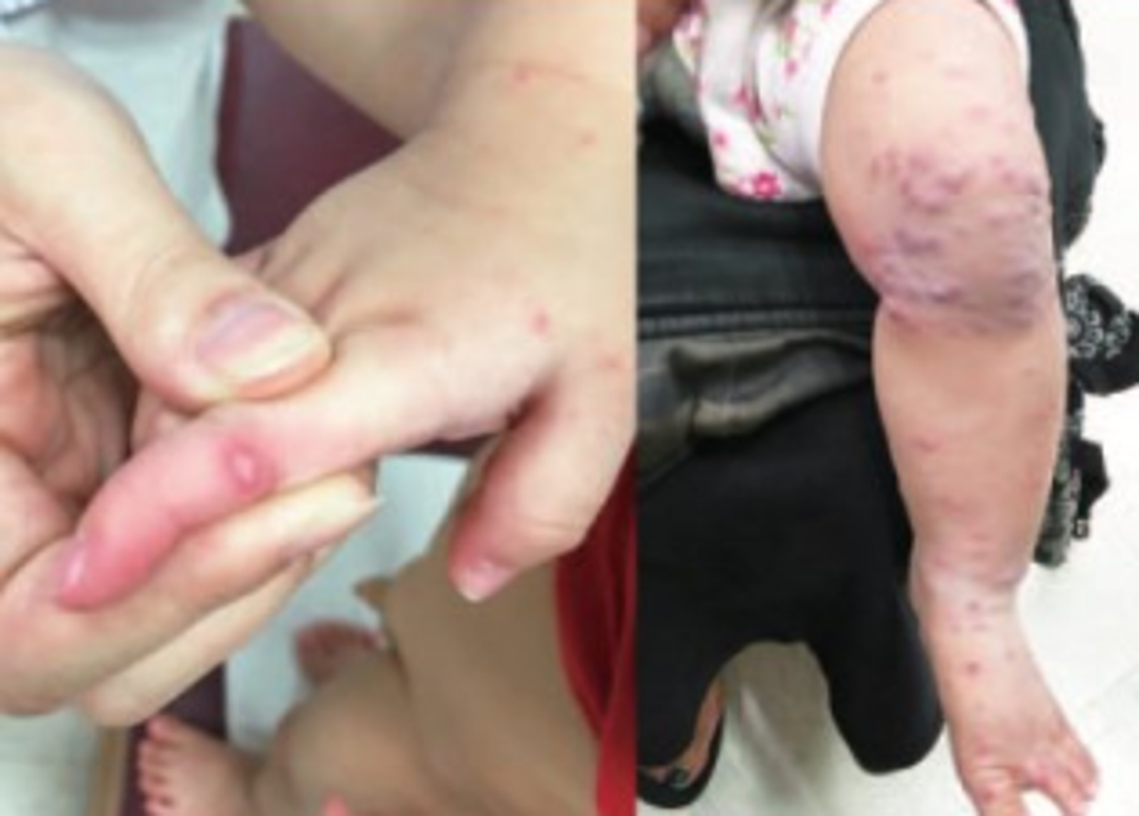 高雄醫護夫妻超夭壽！隱匿「女兒腸病毒」害11童染疫　家長再爆：老師也被逼走