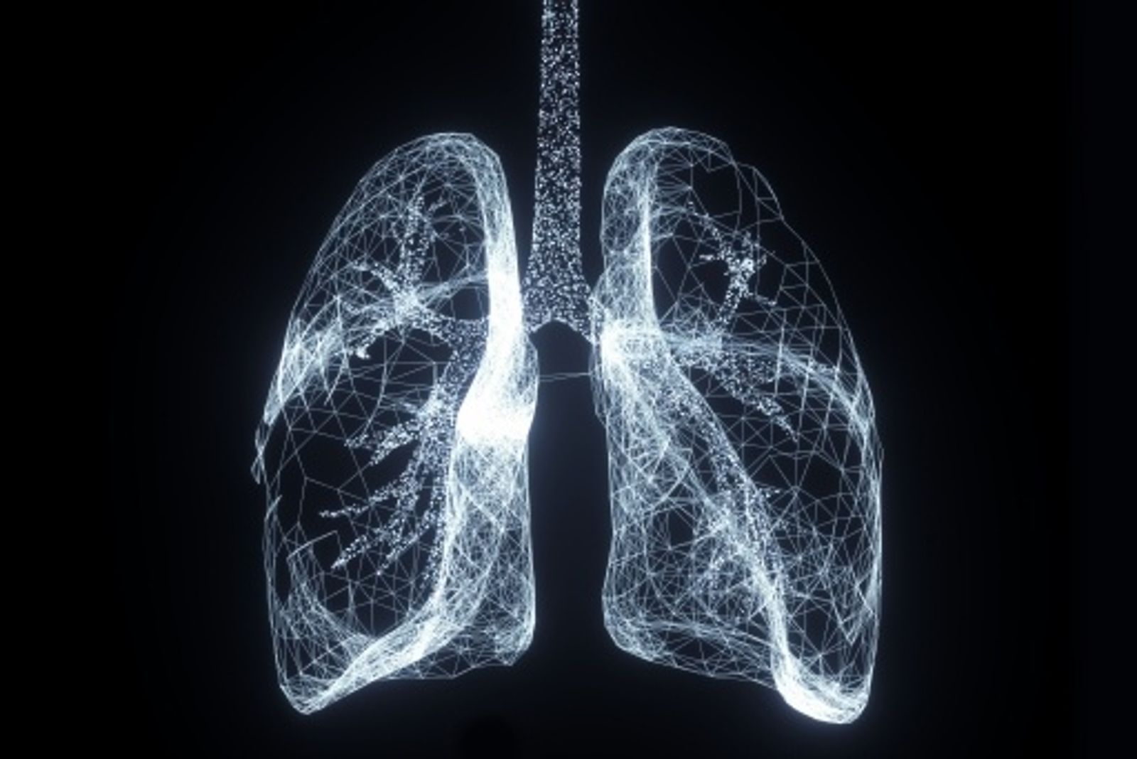 45歲婦見「肺部毛玻璃樣病變」崩潰　醫：3關鍵影響處理方式...未必是癌症
