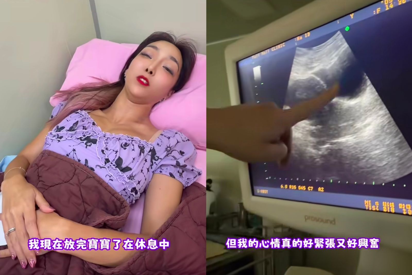 李宓上個月才痛失腹中六寶,今23日宣布再度挑戰懷孕,一次植入2顆胚胎,盼能順利迎接第六個孩子。圖/翻攝李宓Mina臉書