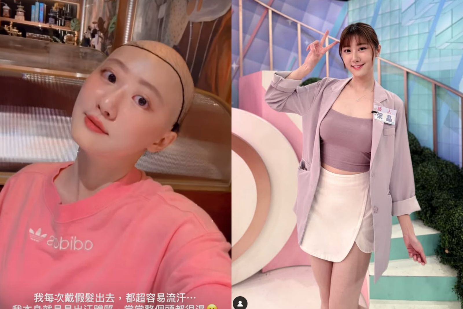 「國光女神」林茉晶罹卵巢癌　消失半年抗癌體重暴增20公斤