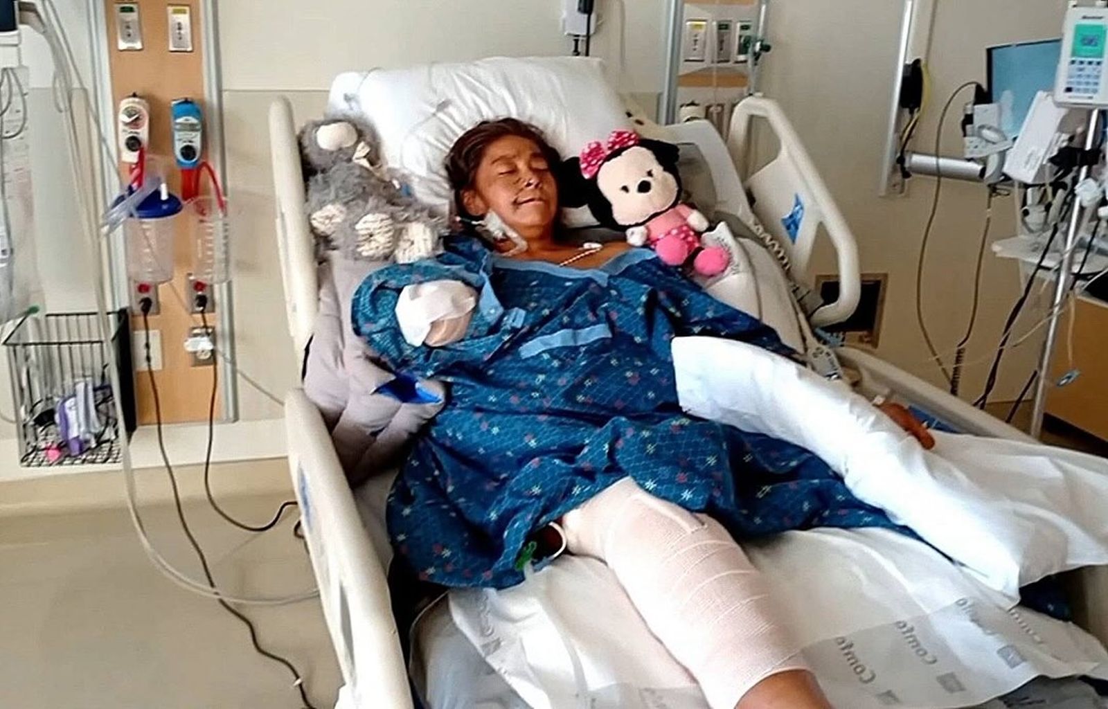 史考特將面臨漫長的復健之路。圖/Abby Blabby FB