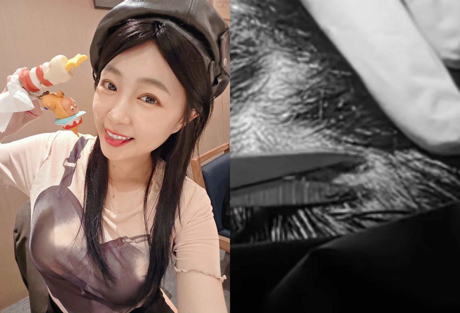 丫頭38歲生日爆「血光之災」!摔破頭「縫5針」傷勢曝光 感慨:人生每天都在倒數