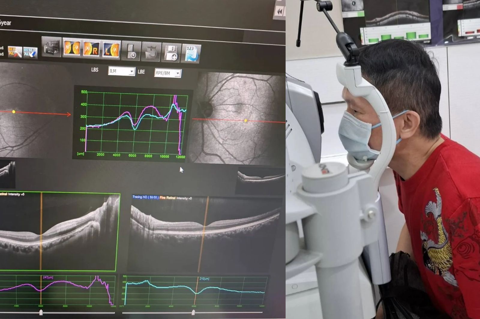 秦楊父親節右眼突失明　錯過黃金6小時搶救期崩潰嘆「人生最黑暗」