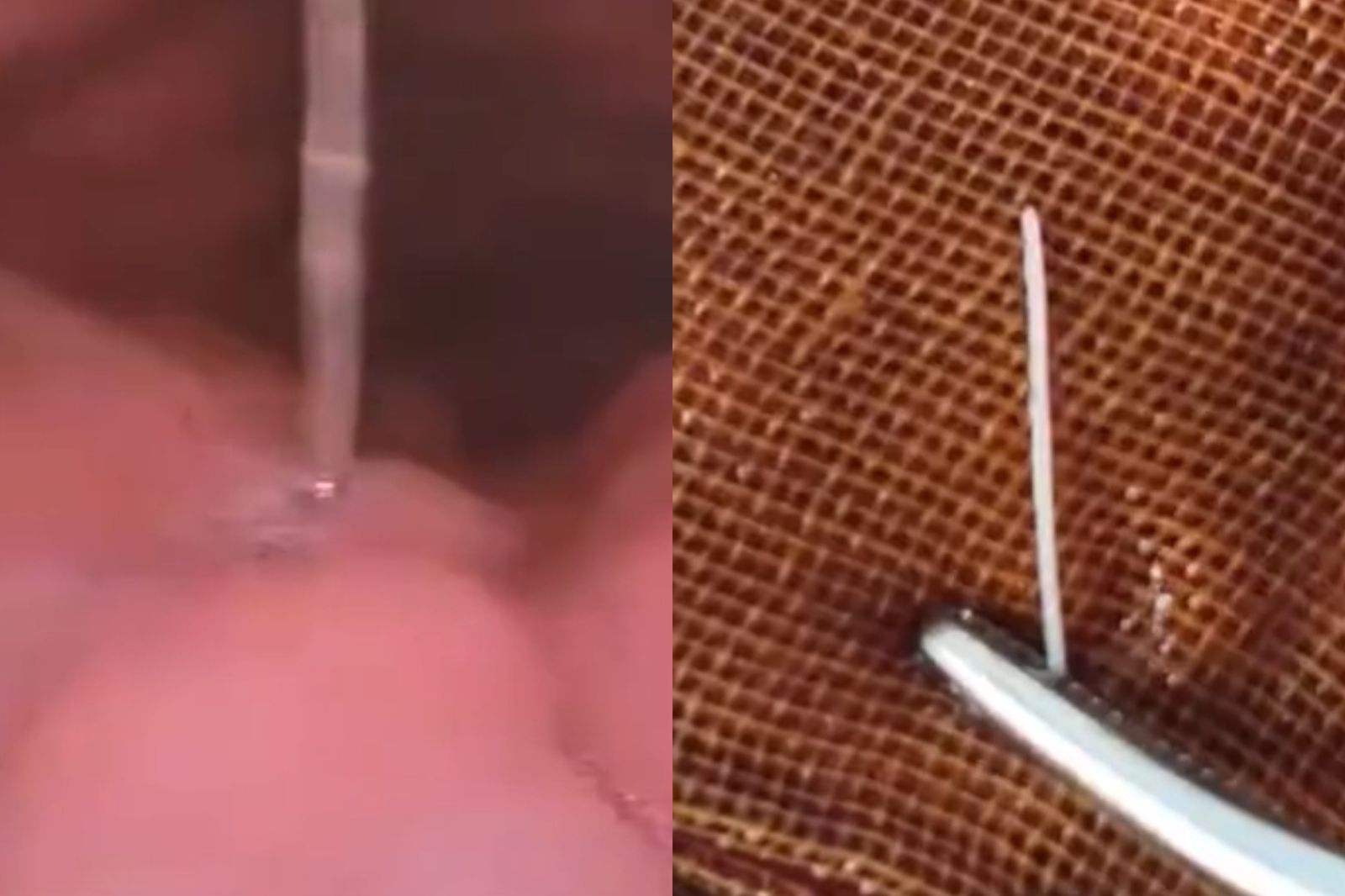 魚刺卡喉嚨！29歲男喝醋、吞飯「隔天吐血喪命」　醫揭2正確應對方法