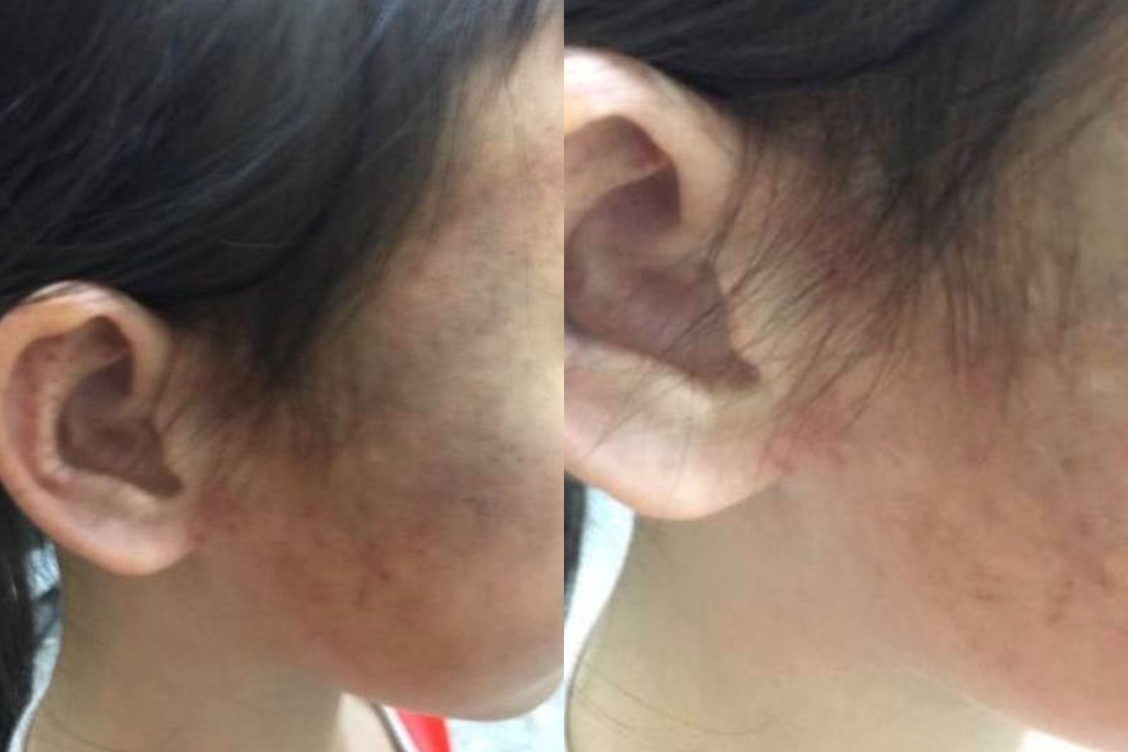 網傳小一女童遭虐！鍾東錦嘆：未經他人苦莫勸他人善　原PO再嗆「所以把她趕出家門是OK的？」　