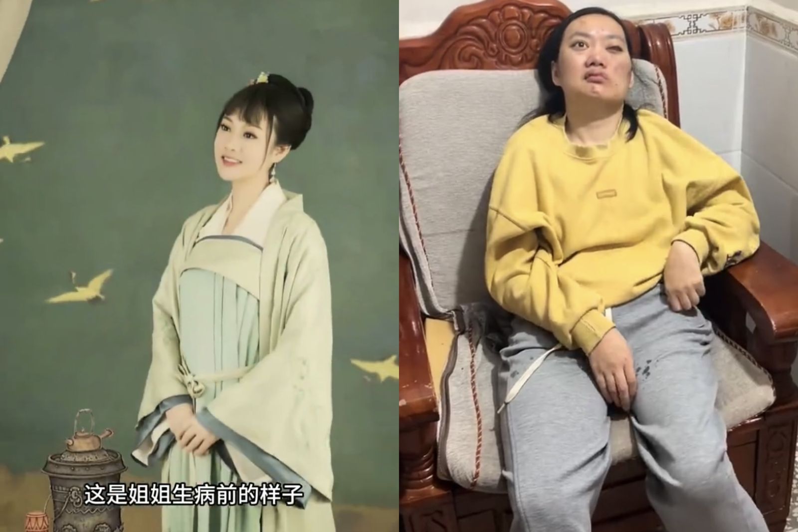 曾是英語老師!她生完孩子後「失明又失聰」 妹妹曝背後病因
