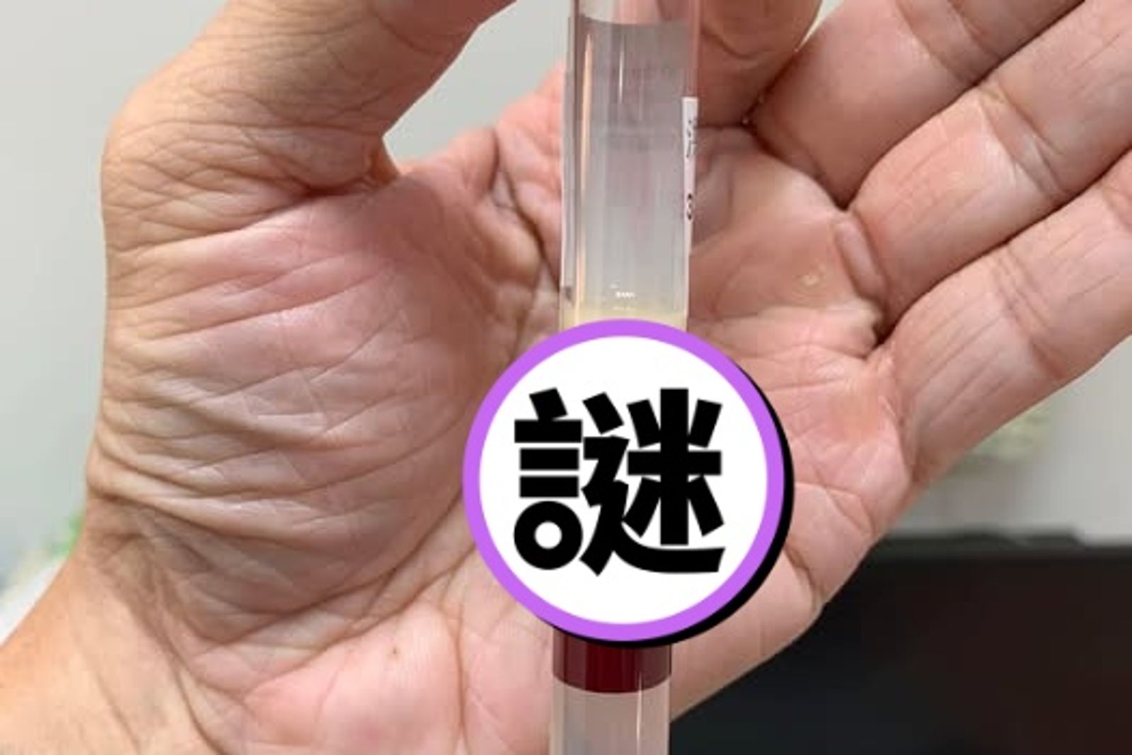 「三酸甘油酯過高」看的出來!醫曝病例 網驚:油是血液2倍...不敢吃炸物了