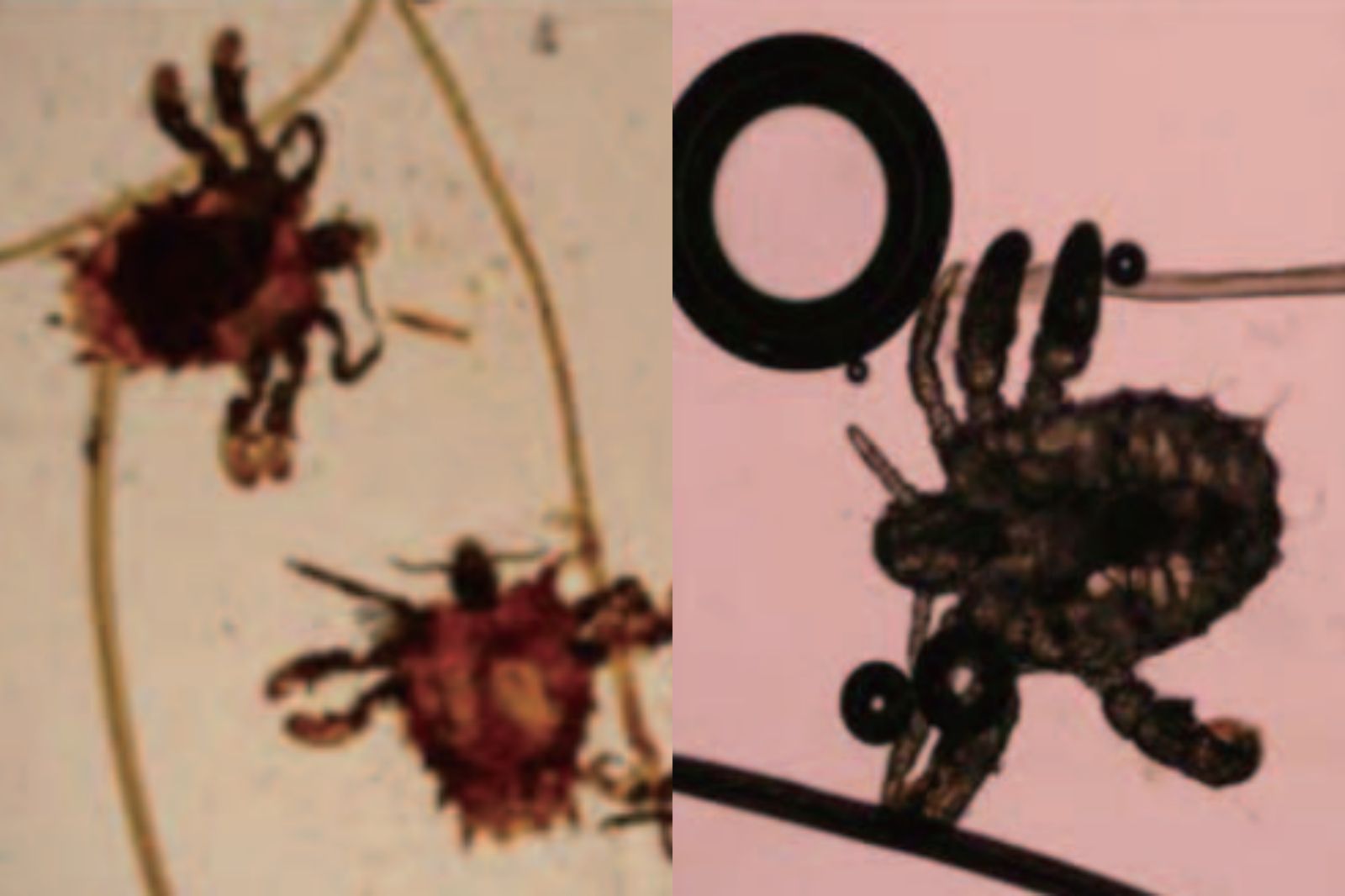 陰蝨成蟲腳會緊勾毛髮。圖／童綜合醫療社團法人童綜合醫院