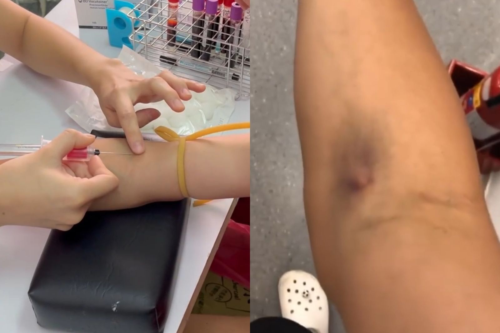 師大強迫學生抽血進行實驗一案引起全台關注。圖/翻攝自Threads/chien_chi_sheng