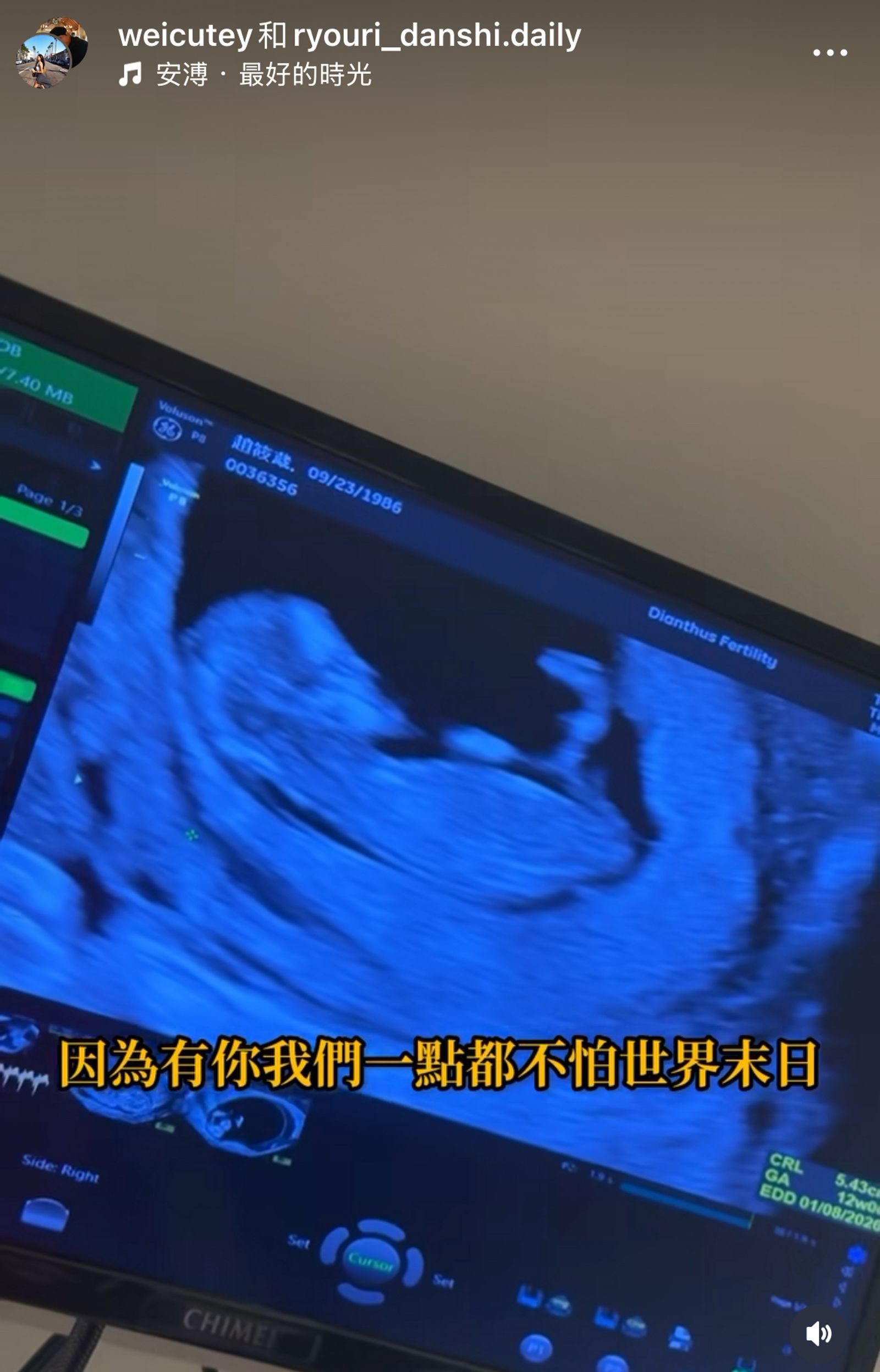 Ivy宣布自己懷孕了。翻攝Ivy IG