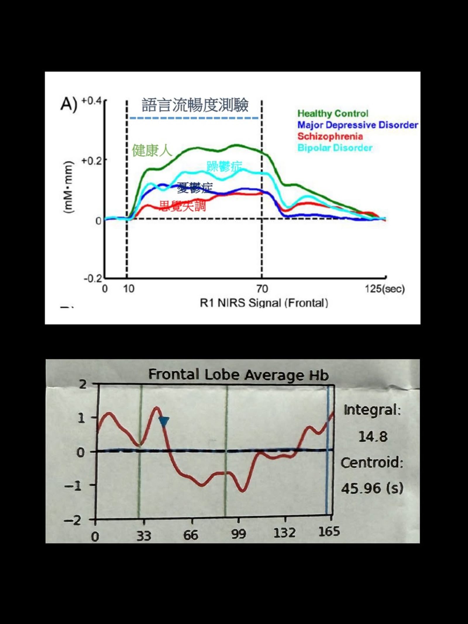 梁云菲的數值遠低於正常人標準。翻攝IG@nanaliangbadgal