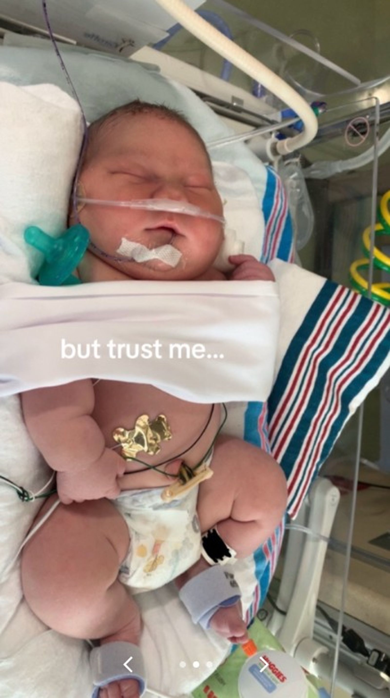 卡西安其實是早產兒。圖/翻攝自TikTok/shlbmrtn