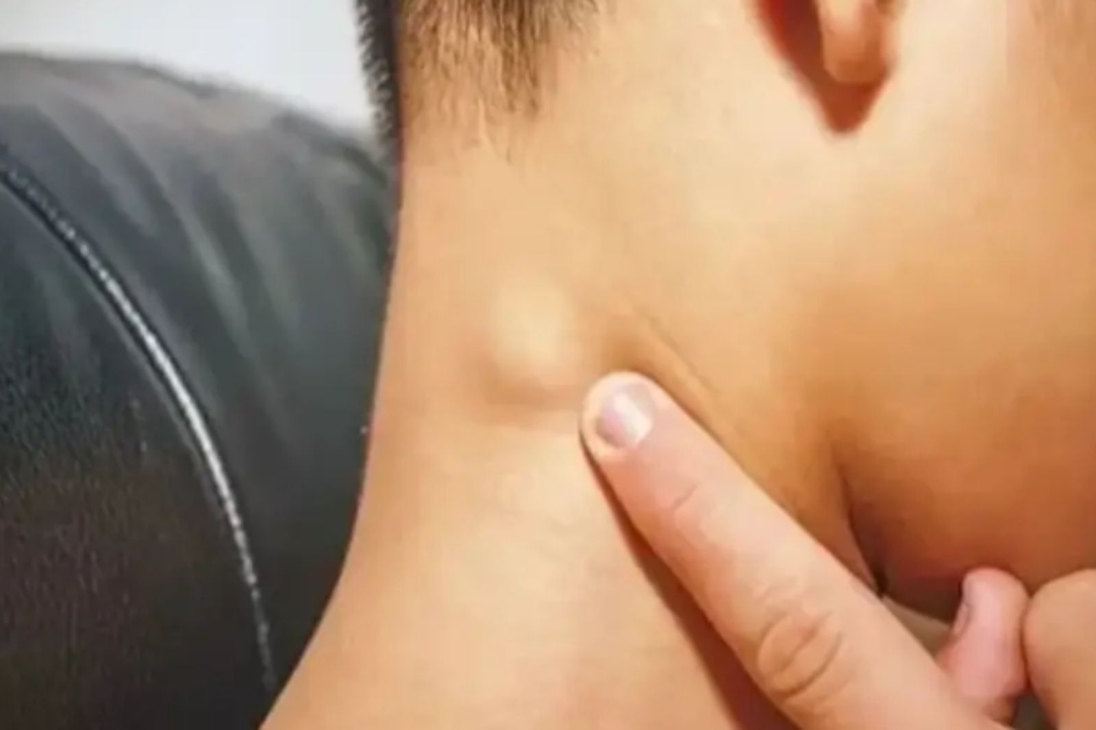 5歲童脖子腫一塊！檢查竟罹「凶險癌症晚期」　醫示警：4症狀快就醫