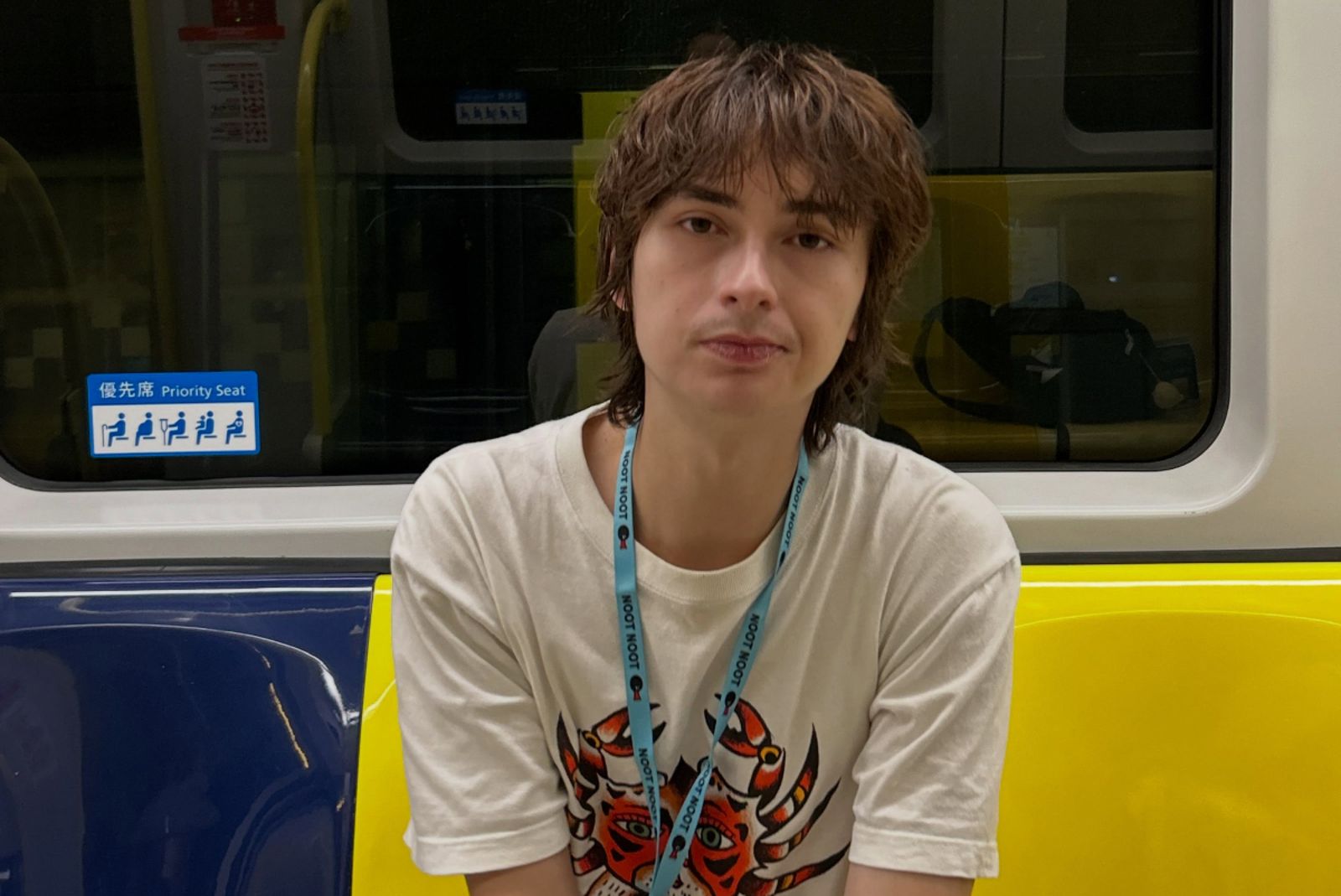 25歲混血網紅罹肝癌!生活計畫全喊卡 曝住院一晚最高6500元