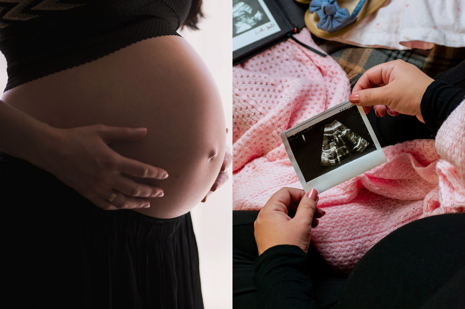 比中樂透還難！她「懷孕中又懷孕」自然產後轉剖腹　醫驚：極罕見雙胞胎