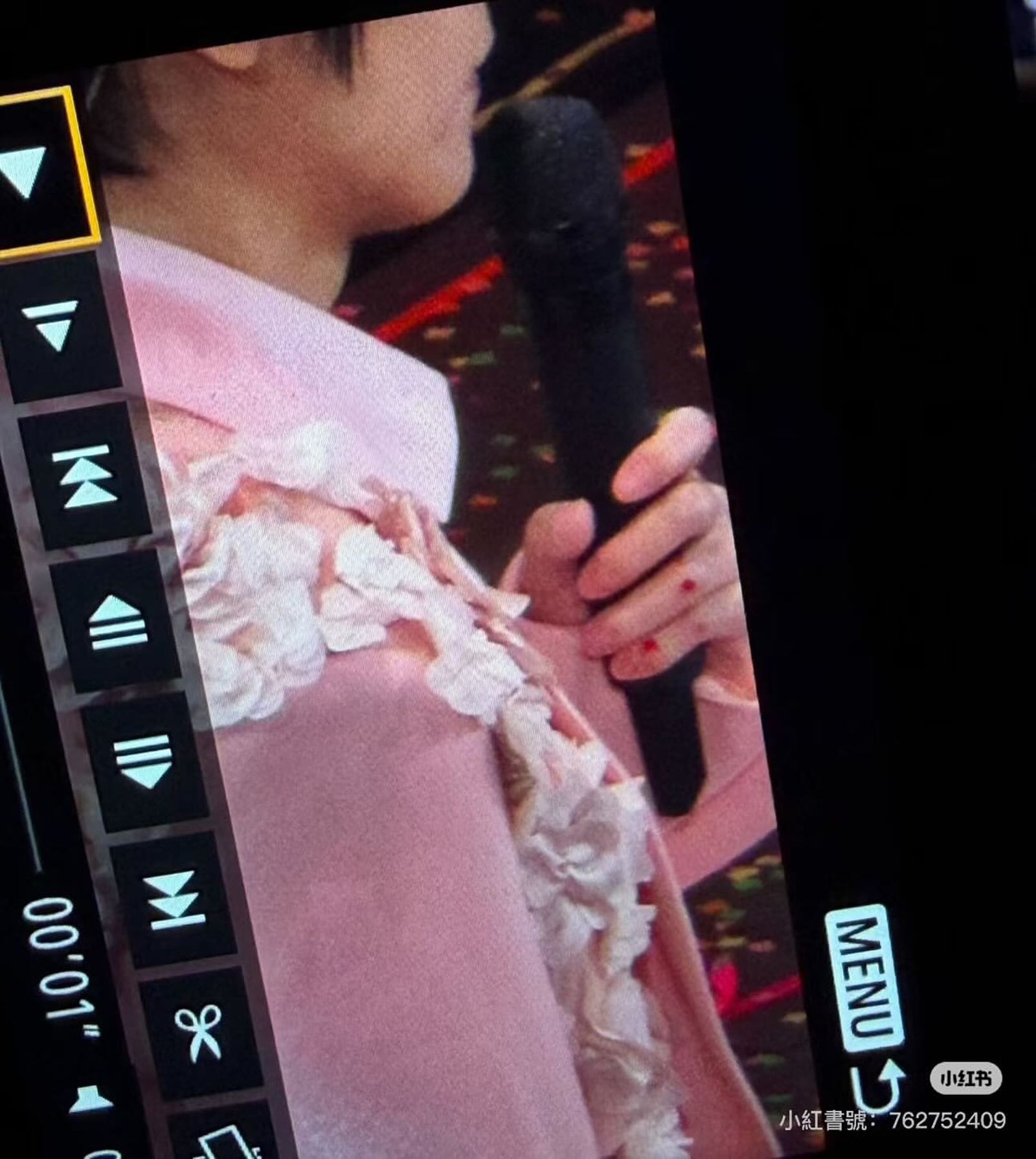阿信跌落舞台被歌迷拍到手上多處傷口。翻攝小紅書