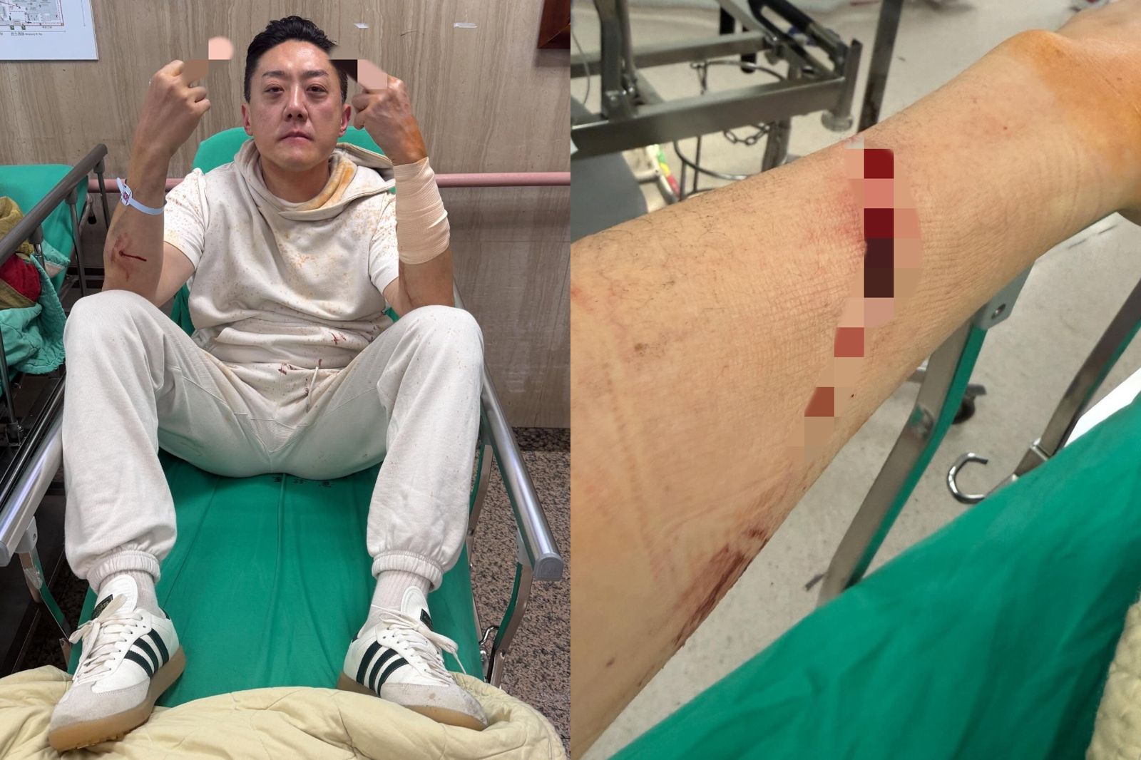 「夜店大亨」夏天倫遭埋伏持刀攻擊！左臂被砍15公分刀傷　疑牽涉前妻恩怨