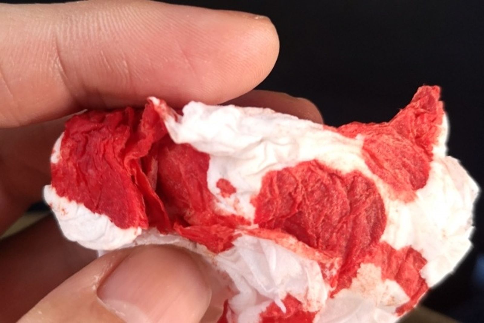 兒膝蓋擦傷!母哭喊「我兒子命盤裡不能見血」要老師開證明...化解血光之災