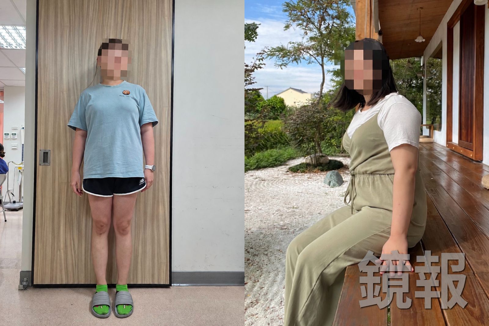 患者原本身材圓潤,體重一度飆達80公斤(圖右),經中醫調理後,一年半內減了20公斤,體態明顯變苗條(圖左)。圖/員榮醫院提供