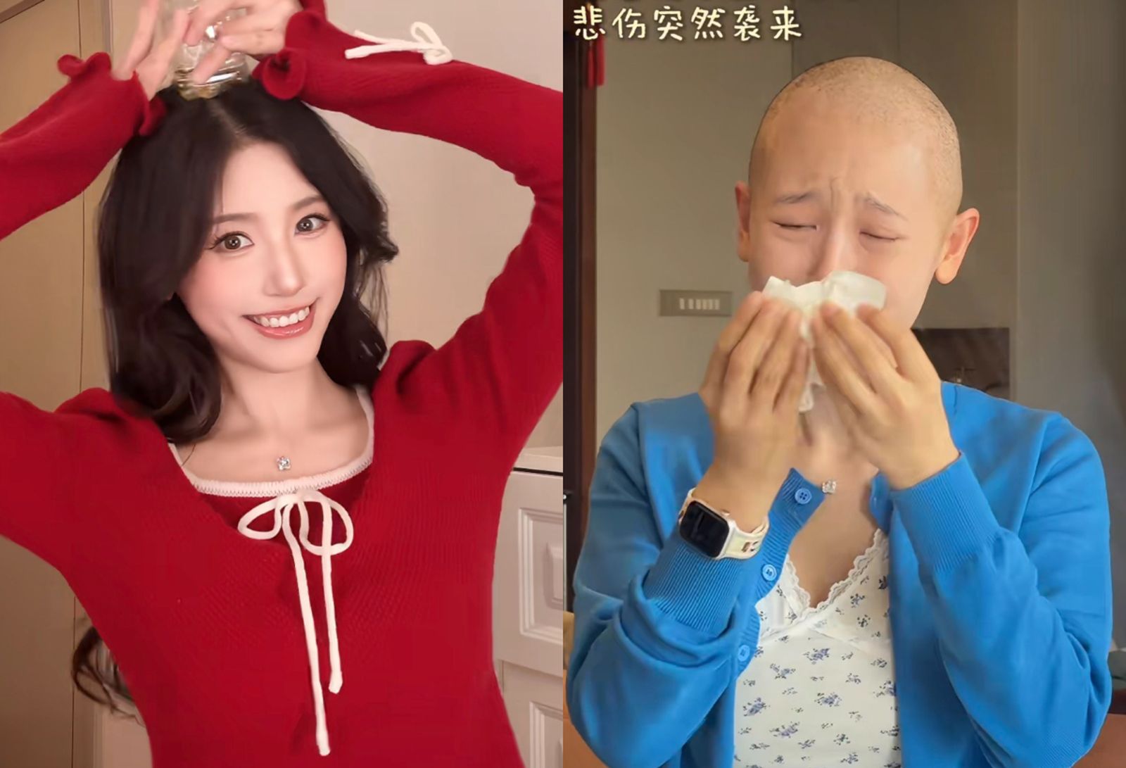 千萬美女網紅罹淋巴癌3期！化療掉髮「主動剃頭」哭了　尪暖陪理光頭共患難