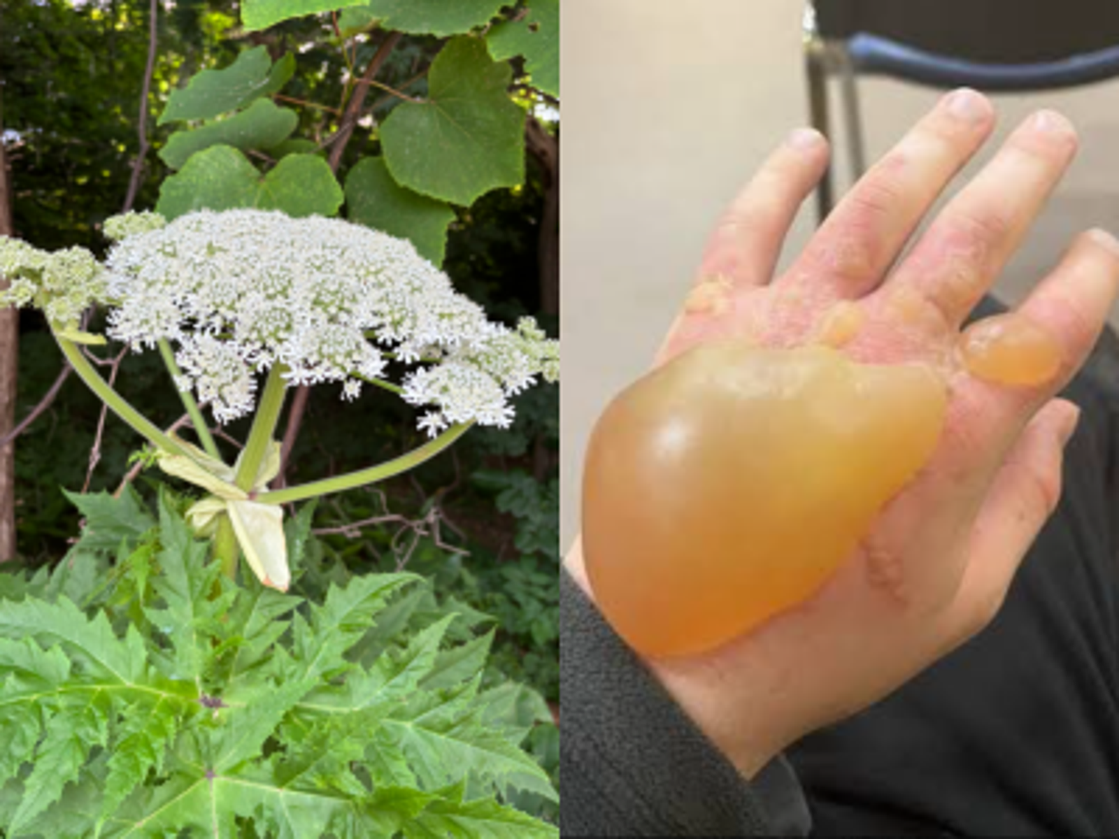 日本、英國旅遊小心!外來「最危險植物」大豕草生長季到 觸碰恐釀巨型水泡、失明