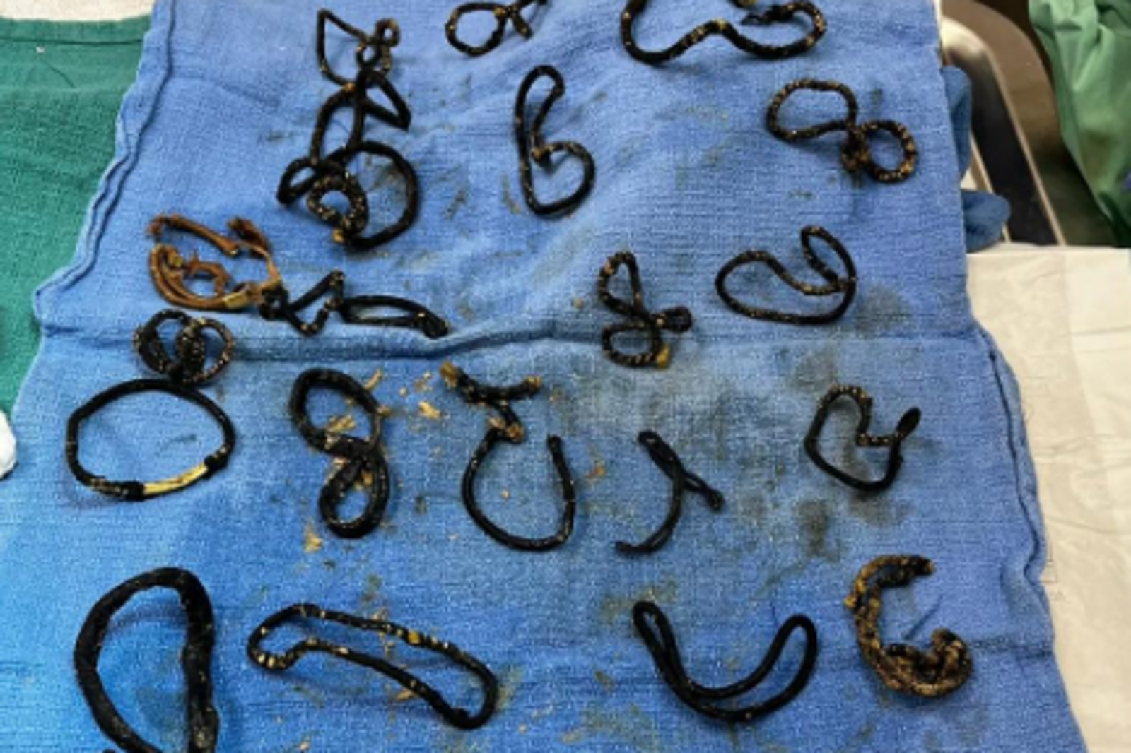 黑貓Midnite準備安樂死進行手術時，才發現竟是胃中26條髮圈導致腸阻塞。圖／翻攝自IG@halonokillrescue