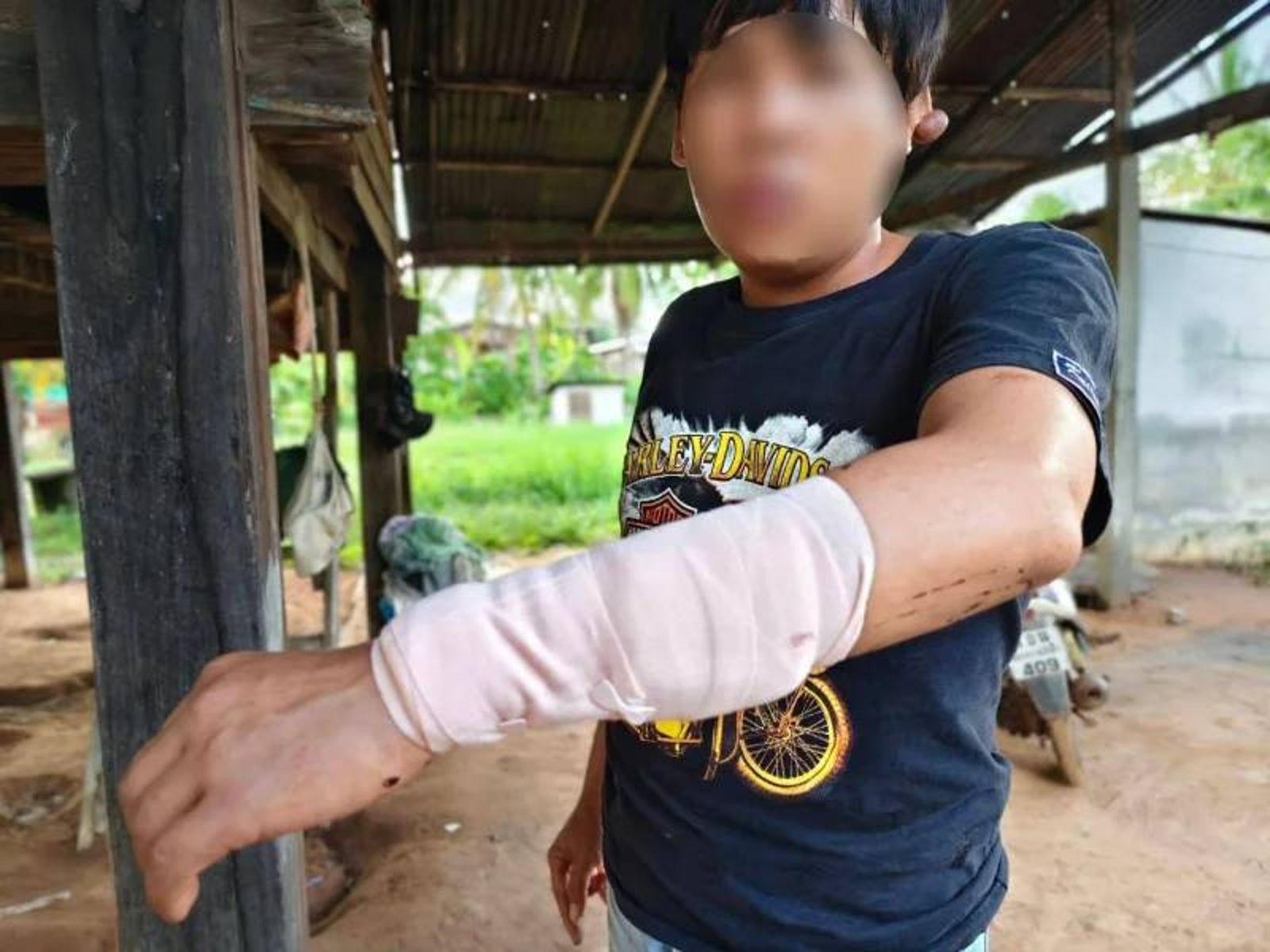 父子為泰國淫僧吵翻!30歲兒持鐵耙猛擊 52歲父遭砍刀反擊「腸子外露」