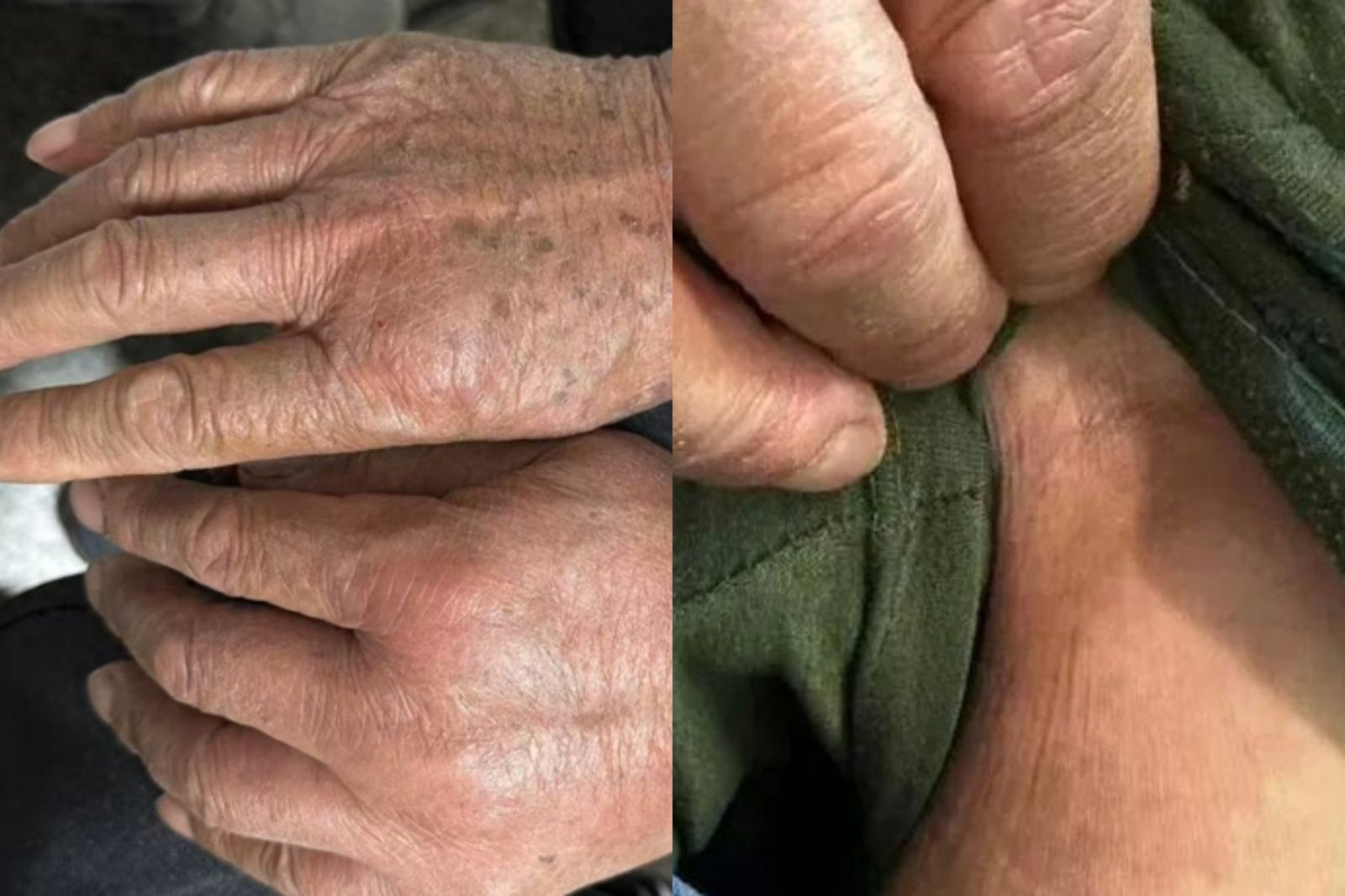 68歲翁遭紅火蟻叮咬！10幾秒爬滿全身　全是「院子1物」惹的禍