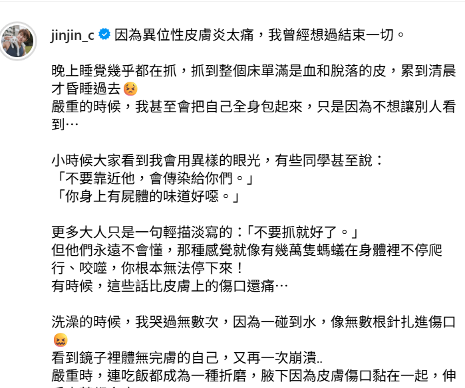鄭靚歆IG分享抗異位性皮膚炎的心境。翻攝jinjin_c IG