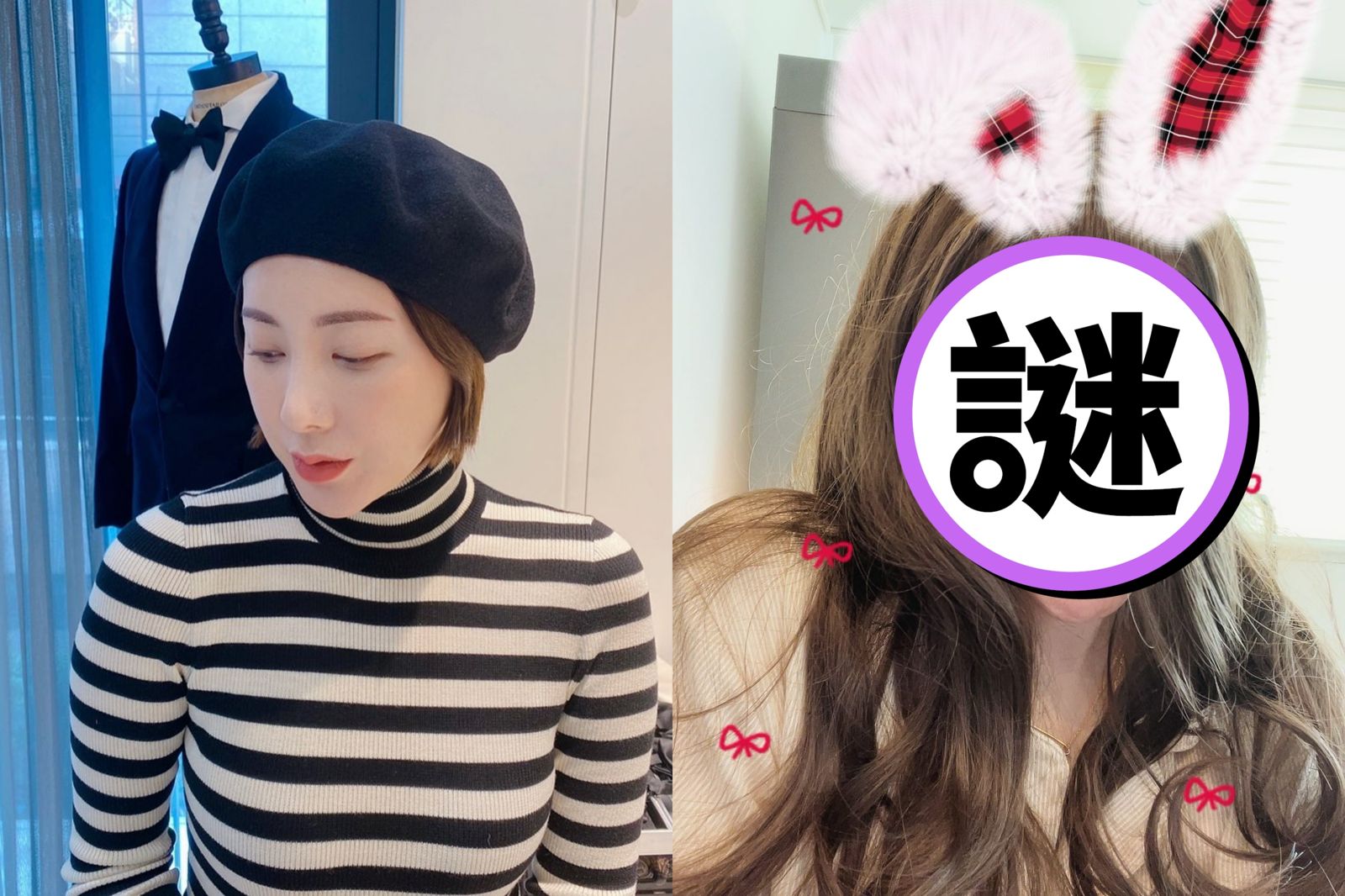 41歲女星閃離富商「變這樣」！徐寅永暴肥10公斤　親吐整形副作用：假體全拆了