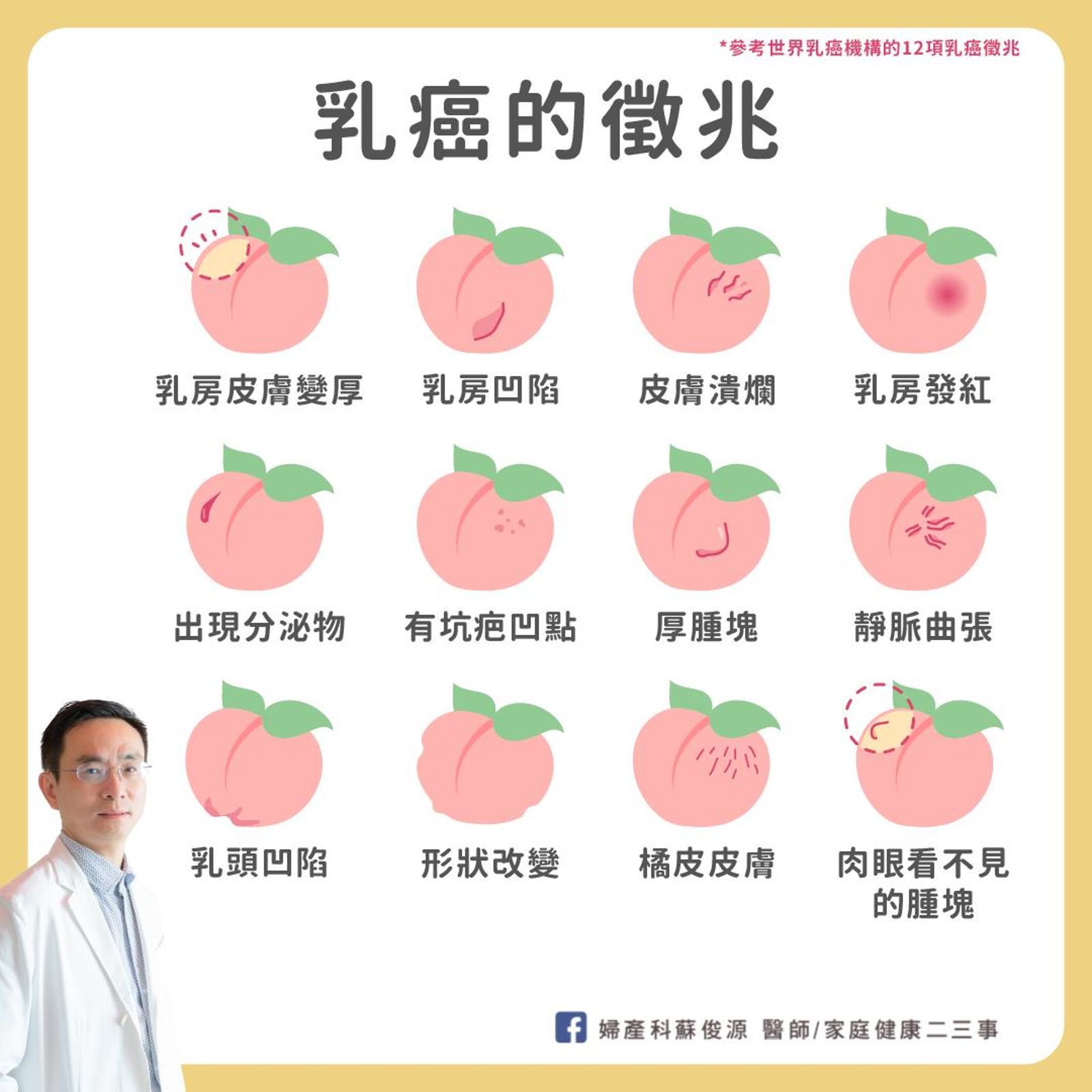 婦產科醫師蘇俊源分享世界乳癌機構曾公布當乳癌出現乳房會出現的12項症狀。翻攝臉書