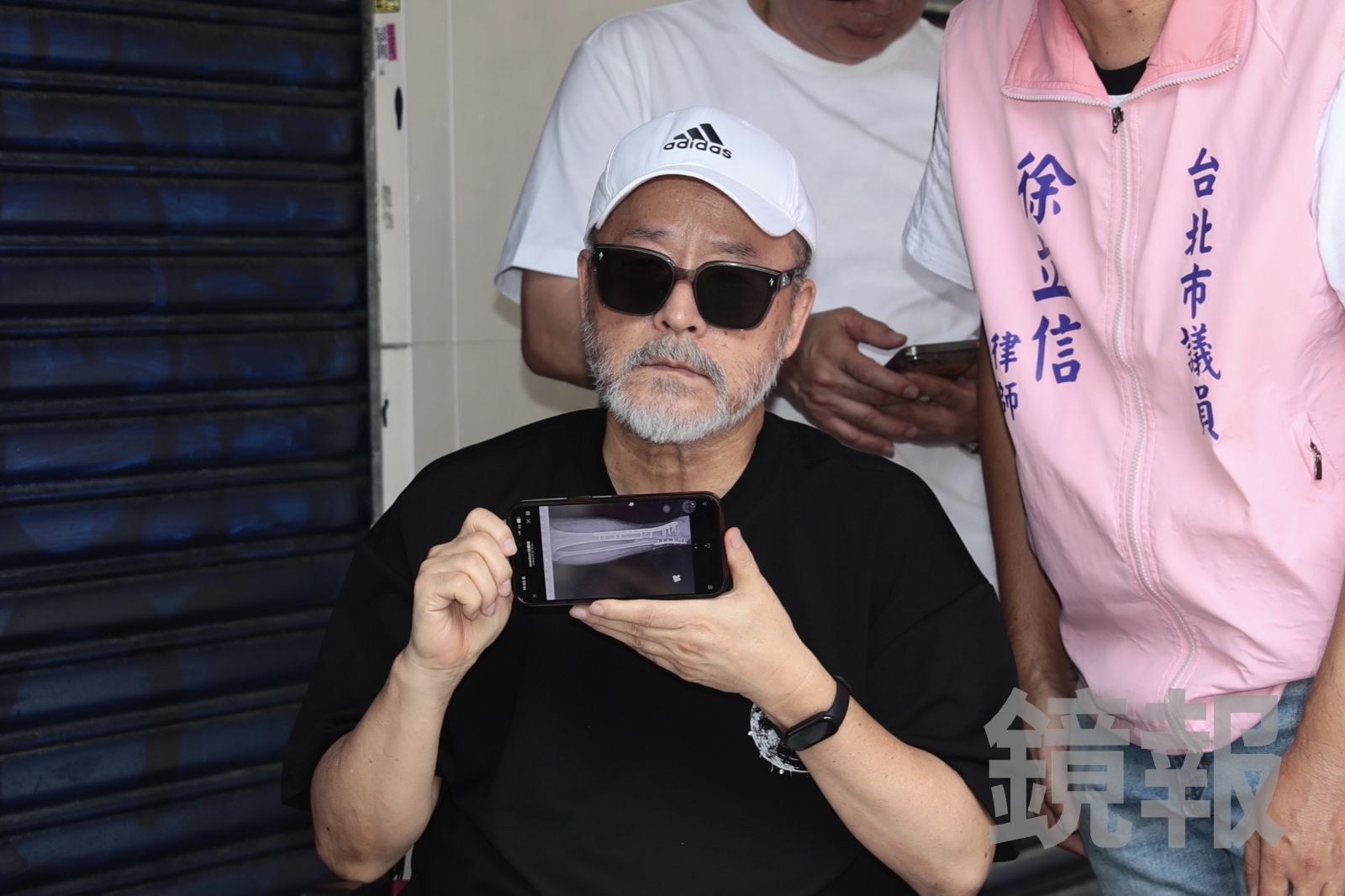 班鐵翔出示受傷X光片。林煒凱攝