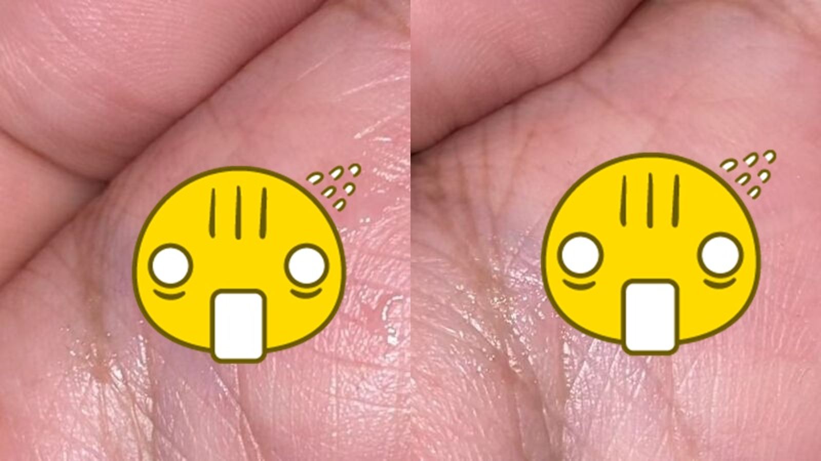 他喉嚨卡3天以為感冒…竟咳出「不明生物」！網看「專家解答」嚇歪：想替你哭了