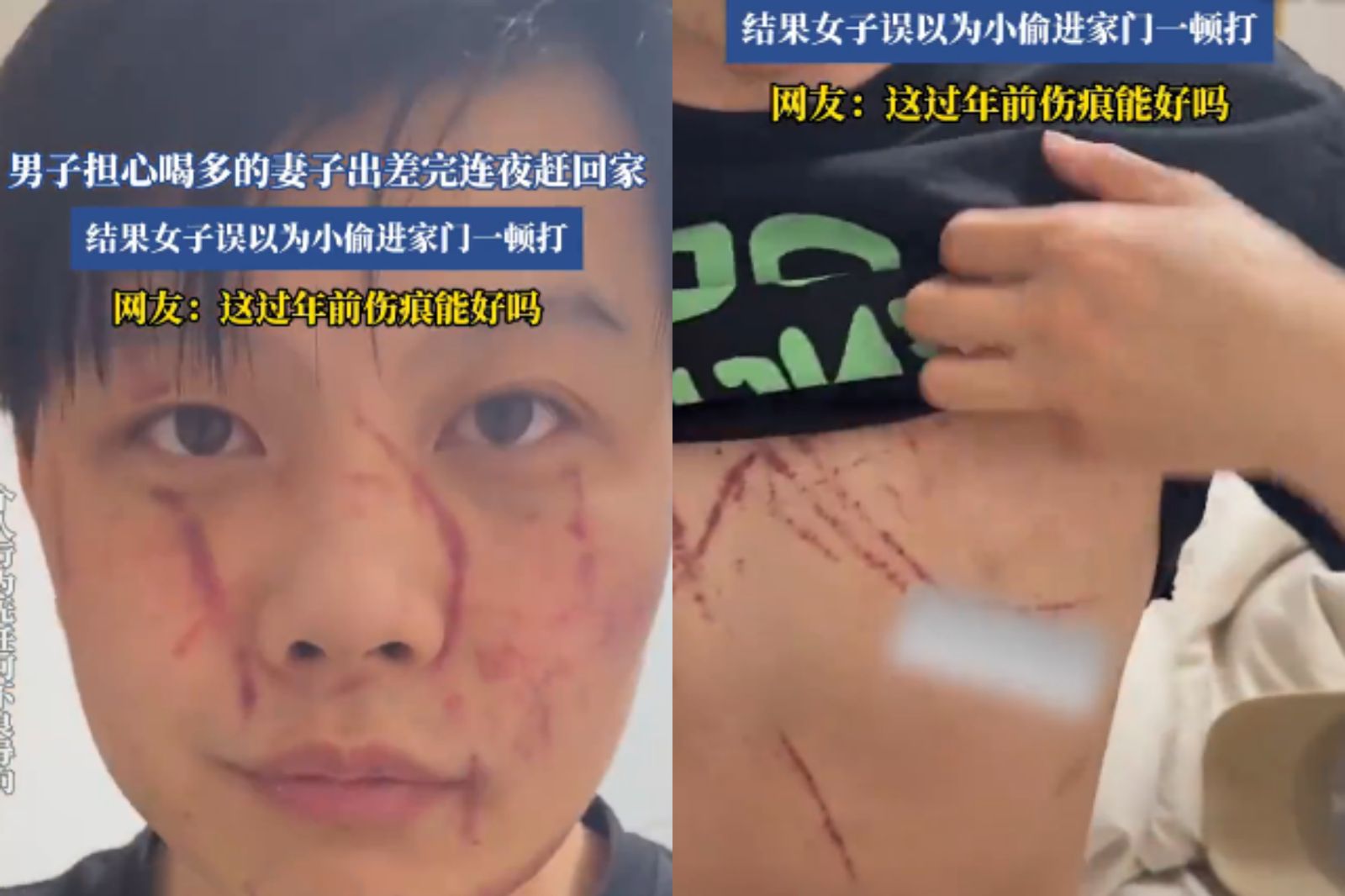 愛妻喝到爛醉!夫深夜飛奔回家反遭「九陰白骨爪」伺候 背後原因暖哭網友