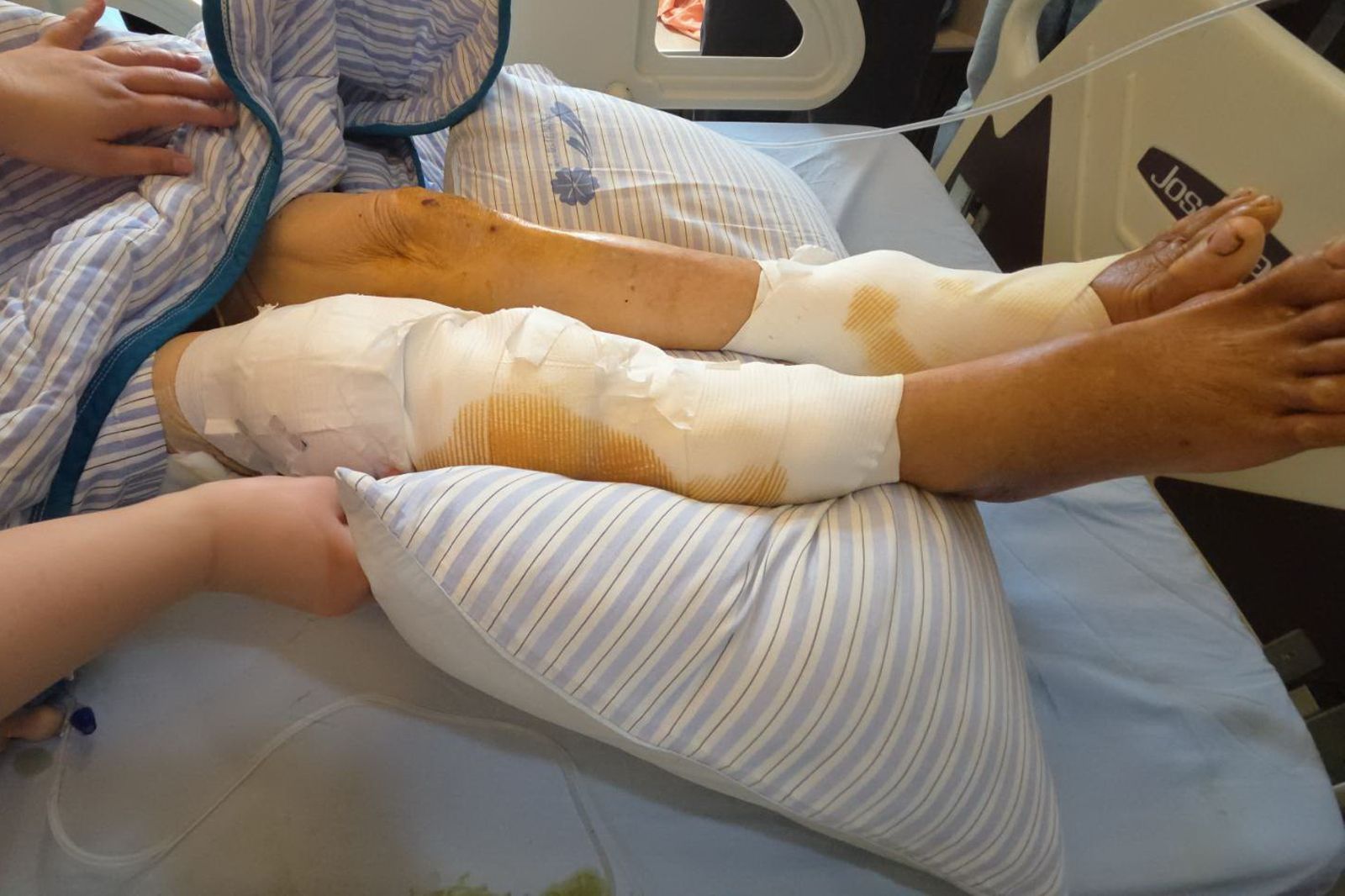 彰化8旬婦遭3犬追咬拖行 「血濺百米」傷口逾百處 家屬控飼主藏狗盼追查