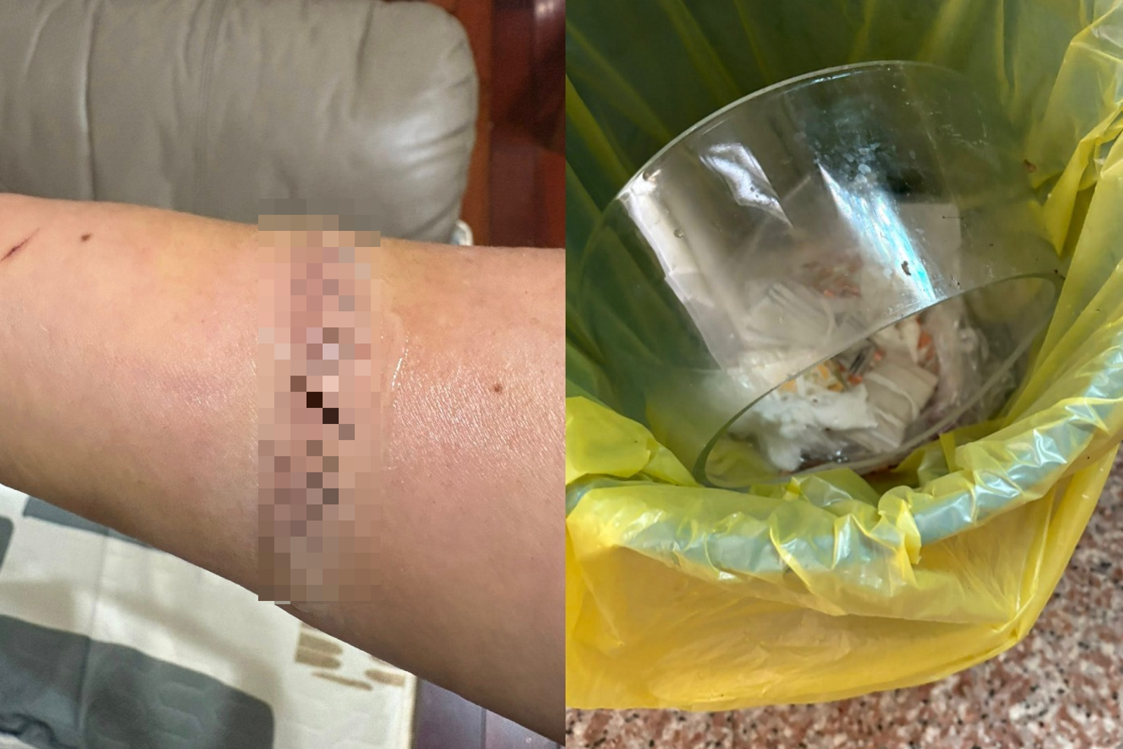 全聯換購保鮮盒突爆裂!「割斷手臂肌腱」驚悚畫面流出 釣出一大批苦主