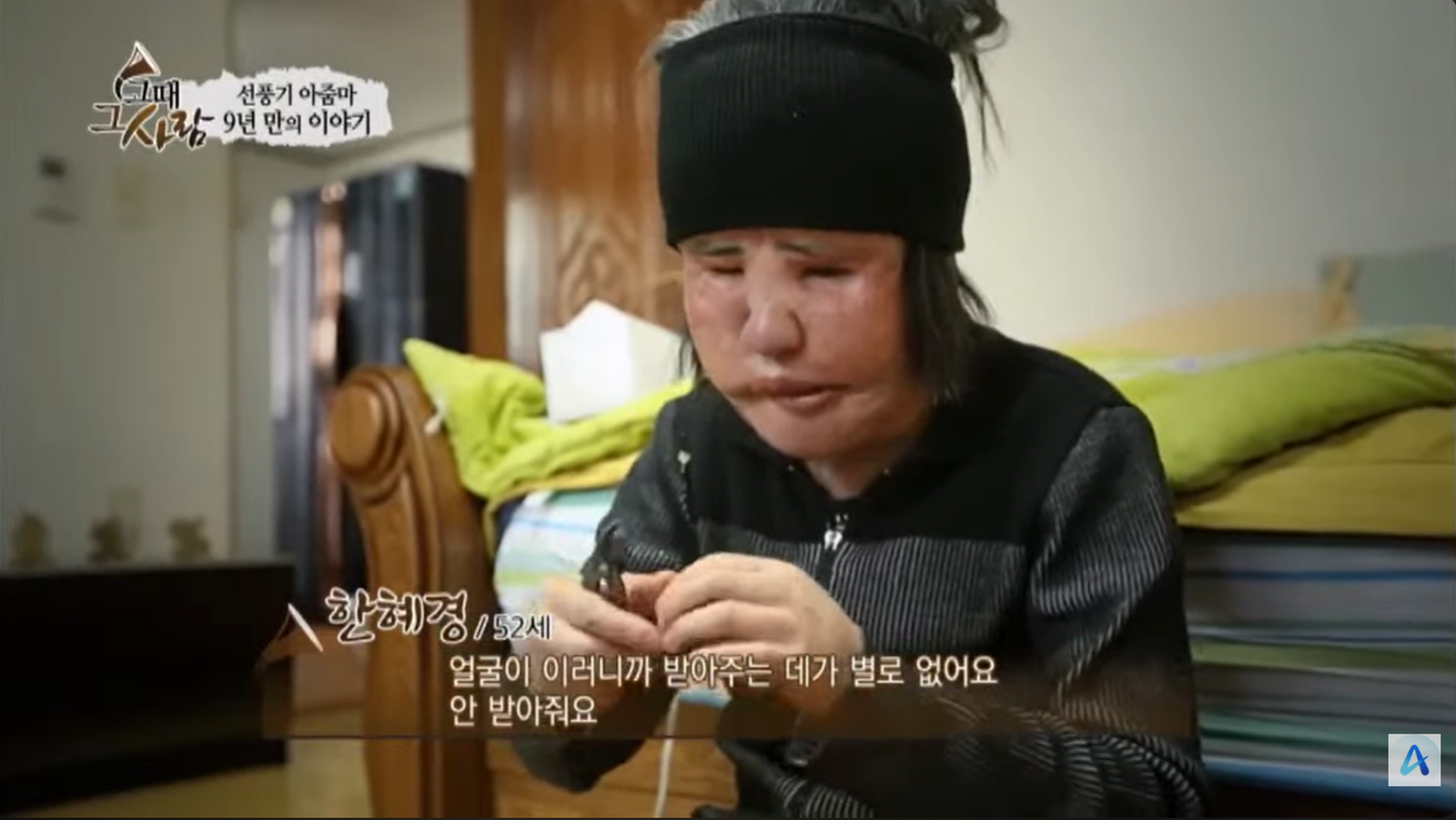 韓慧景2013年現身時已接受過多次整形重建手術。翻攝Channel A