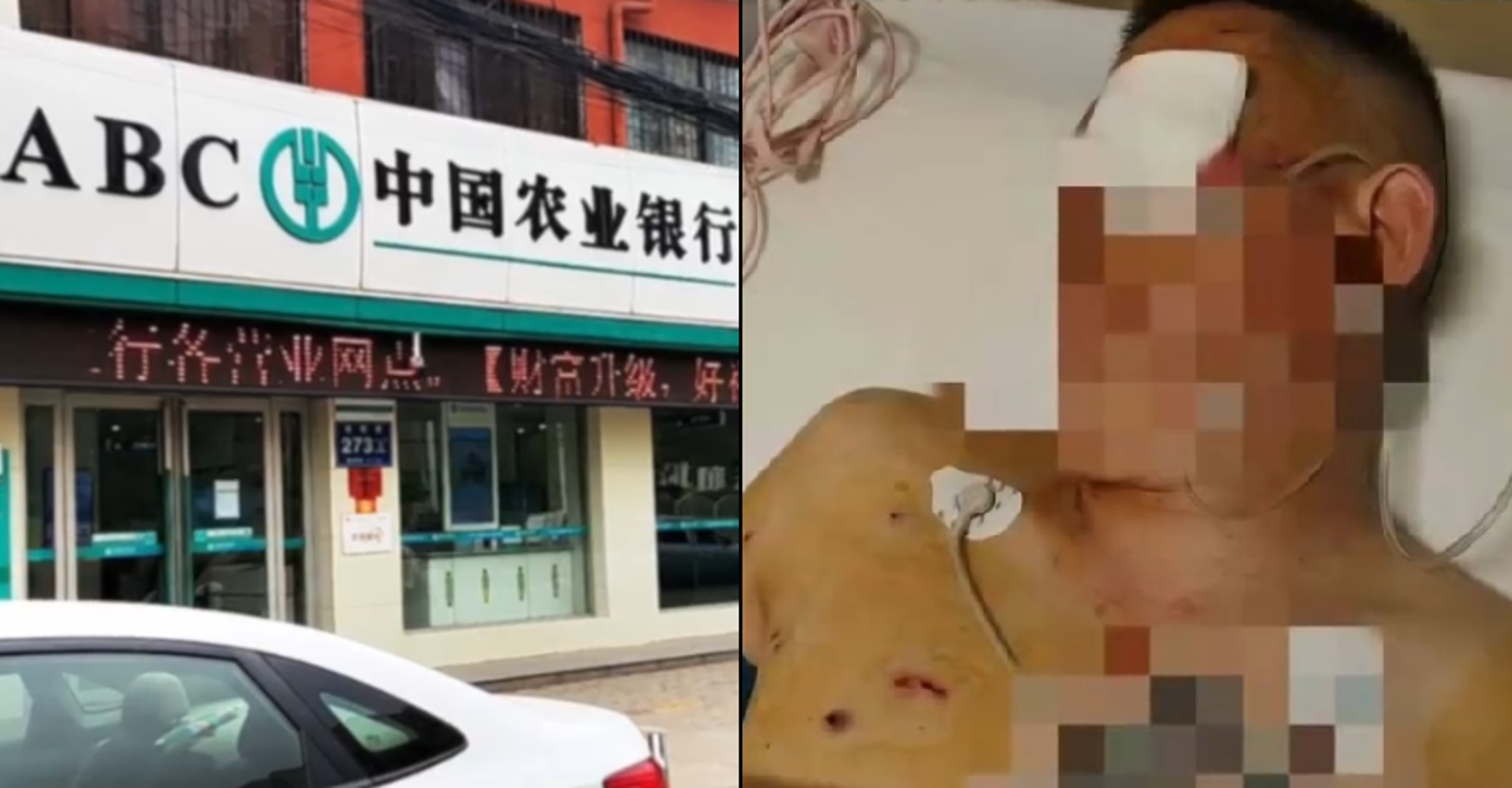 客戶預約銀行領鉅款出門即遭搶　搏鬥20分鐘……助理、保全全程靜默