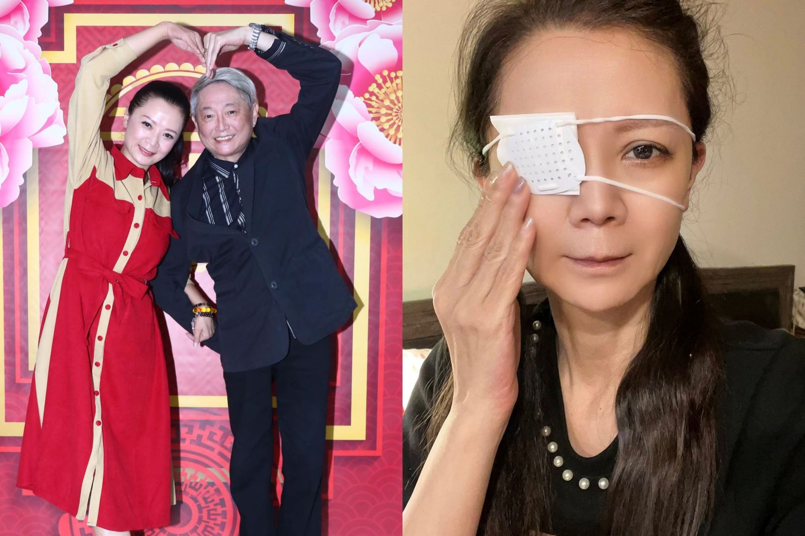 高欣欣誤點眼藥,由老公李國超(左二)送醫治療。翻攝高欣欣臉書