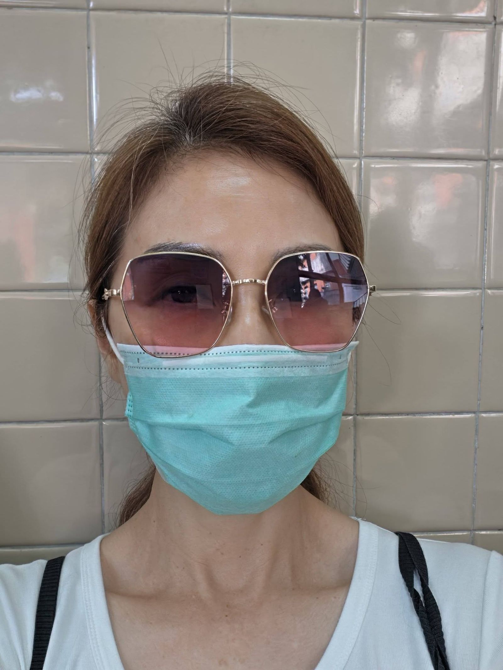 梁佑南分享術後現況。翻攝梁佑南 Emily Liang臉書